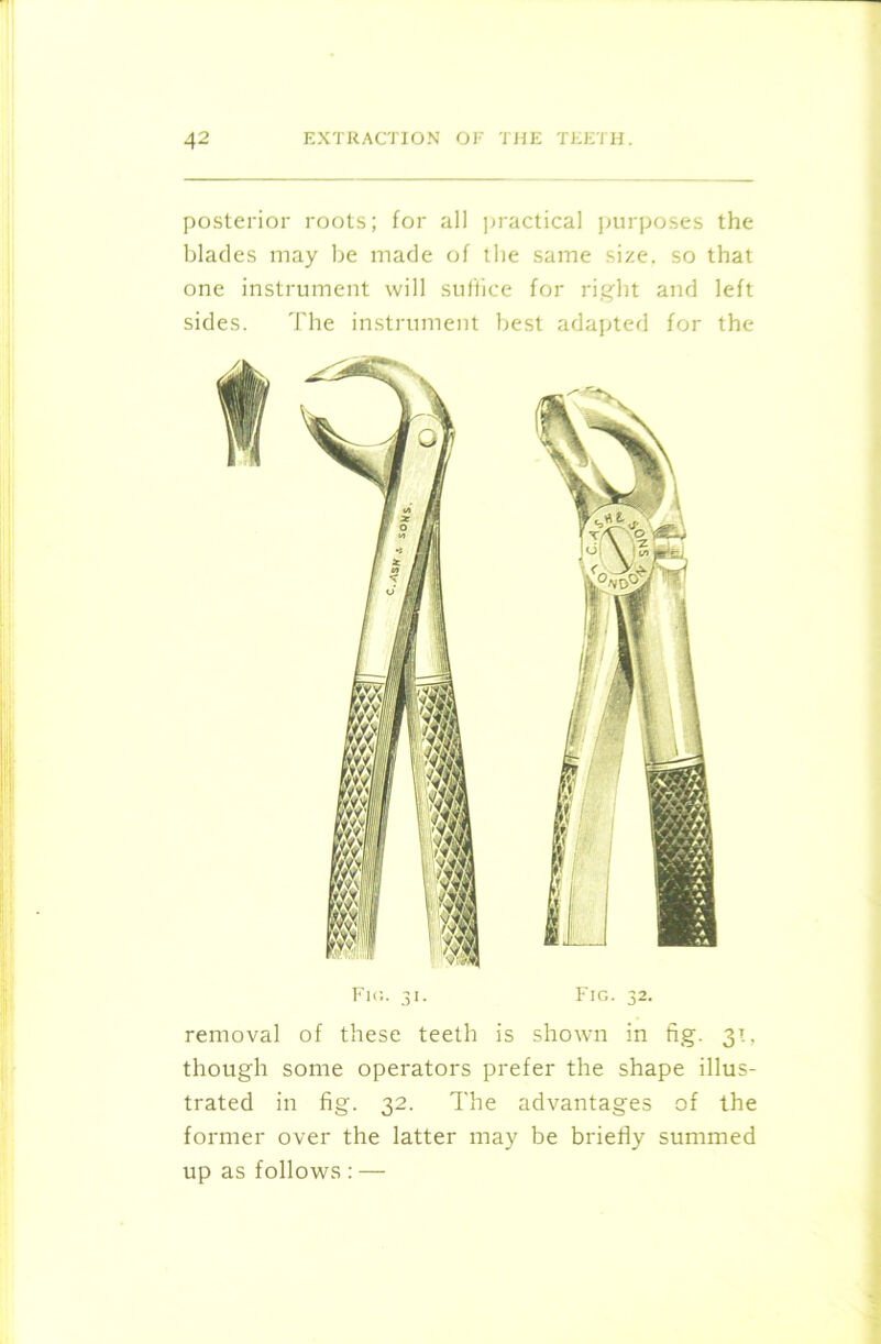 posterior roots; for all practical purposes the blades may be made of the same size, so that one instrument will suffice for right and left sides. The instrument best adapted for the Fir,. 31. Fig. 32. removal of these teeth is shown in fig. 31, though some operators prefer the shape illus- trated in fig. 32. The advantages of the former over the latter may be briefly summed up as follows : —