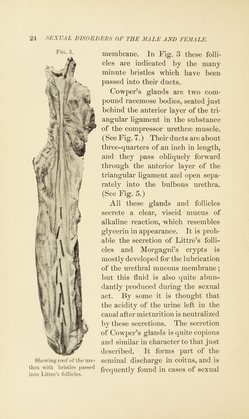 Fig. 3. Showing roof of the ure- thra with bristles passed into Littre’s follicles. membrane. In Fig. 3 these folli- cles are indicated by the many minute bristles which have been passed into their ducts. Cowper’s glands are two com- pound racemose bodies, seated just behind the anterior layer of the tri- angular ligament in the substance of the compressor urethrae muscle. (See Fig. 7.) Their ducts are about three-quarters of an inch in length, and they pass obliquely forward through the anterior layer of the triangular ligament and open sepa- rately into the bulbous urethra. (See Fig. 5.) All these glands and follicles secrete a clear, viscid mucus of alkaline reaction, which resembles glycerin in appearance. It is prob- able the secretion of Littre’s folli- cles and Morgagni’s crypts is mostly developed for the lubrication of the urethral mucous membrane; but this fluid is also quite abun- dantly produced during the sexual act. By some it is thought that the acidity of the urine left in the canal after micturition is neutralized by these secretions. The secretion of Cowper’s glands is quite copious and similar in character to that just described. It forms part of the seminal discharge in coitus, and is frequently found in cases of sexual