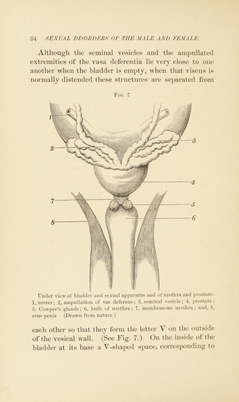 Although the seminal vesicles and the ampullated extremities of the vasa deferentia lie very close to one another when the bladder is empty, when that viscus is normally distended these structures are separated from Fig. 7 Under view of bladder and sexual apparatus and ot urethra and prostate. 1, ureter; 2, ampullation of vas deferens; 3, seminal vesicle; 4, prostate; 5. Cowper’s glands; 6, bulb of urethra; 7, membranous urethra; and, 8, crus penis (Drawn from nature.) each other so that they form the letter V on the outside of the vesical wall. (See Fig. 7.) On the inside ot the bladder at its base a V-shaped space, corresponding to