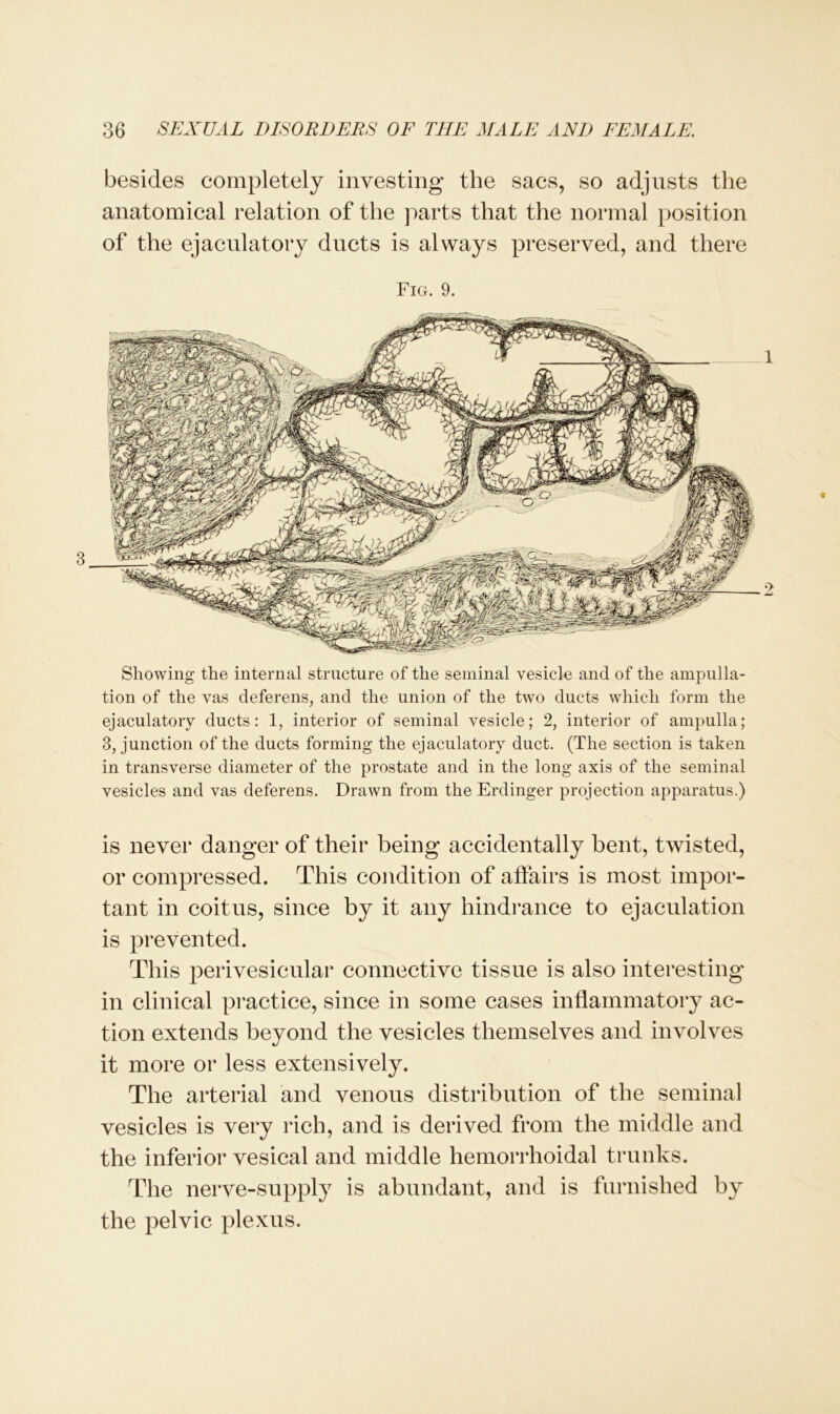 besides completely investing the sacs, so adjusts the anatomical relation of the parts that the normal position of the ejaculatory ducts is always preserved, and there Fig. 9. Showing the internal structure of the seminal vesicle and of the amplia- tion of the vas deferens, and the union of the two ducts which form the ejaculatory ducts: 1, interior of seminal vesicle; 2, interior of ampulla; 3, junction of the ducts forming the ejaculatory duct. (The section is taken in transverse diameter of the prostate and in the long axis of the seminal vesicles and vas deferens. Drawn from the Erdinger projection apparatus.) is never danger of their being accidentally bent, twisted, or compressed. This condition of affairs is most impor- tant in coitus, since by it any hindrance to ejaculation is prevented. This perivesicular connective tissue is also interesting' in clinical practice, since in some cases inflammatory ac- tion extends beyond the vesicles themselves and involves it more or less extensively. The arterial and venous distribution of the seminal vesicles is very rich, and is derived from the middle and the inferior vesical and middle hemorrhoidal trunks. The nerve-supply is abundant, and is furnished by the pelvic plexus.