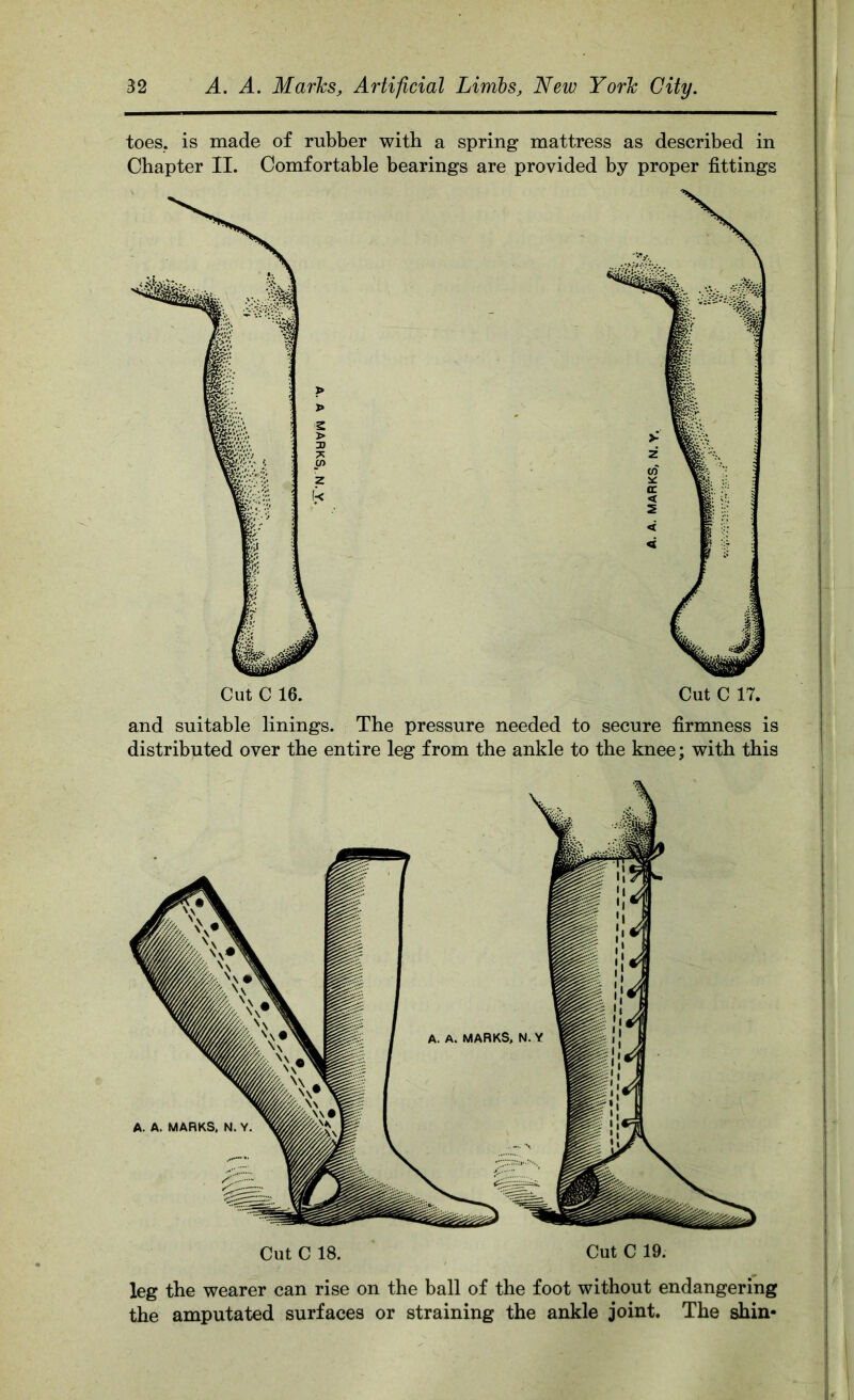 toes, is made of rubber with a spring mattress as described in Chapter II. Comfortable bearings are provided by proper fittings and suitable linings. The pressure needed to secure firmness is distributed over the entire leg from the ankle to the knee; with this leg the wearer can rise on the ball of the foot without endangering the amputated surfaces or straining the ankle joint. The shin-