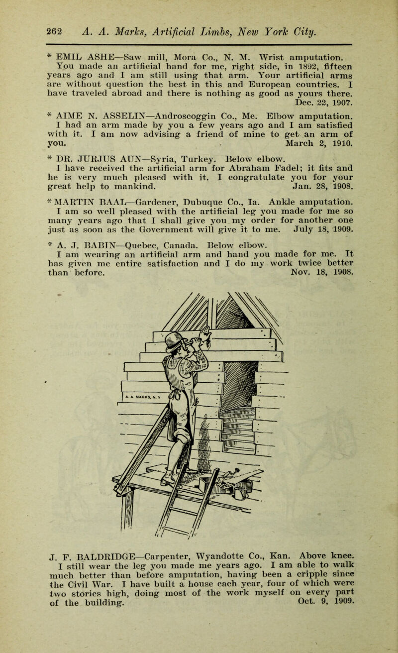 * EMIL ASHE—Saw mill, Mora Co., N. M. Wrist amputation. You made an artificial hand for me, right side, in 1892, fifteen years ago and I am still using that arm. Your artificial arms are without question the best in this and European countries. I have traveled abroad and there is nothing as good as yours there. Dec. 22, 1907. * AIME N. ASSELIN—Androscoggin Co., Me. Elbow amputation. I had an arm made by you a few years ago and I am satisfied with it. I am now advising a friend of mine to get an arm of you. March 2, 1910. * DR. JURJUS AUN—Syria, Turkey. Below elbow. I have received the artificial arm for Abraham Fadel; it fits and he is very much pleased with it. I congratulate you for your great help to mankind. Jan. 28, 1908. * MARTIN BAAL—Gardener, Dubuque Co., la. Ankle amputation. I am so well pleased with the artificial leg you made for me so many years ago that I shall give you my order for another one just as soon as the Government will give it to me. July 18, 1909. * A. J. BABIN—Quebec, Canada. Below elbow. I am wearing an artificial arm and hand you made for me. It has given me entire satisfaction and I do my work twice better than before. Nov. 18, 1908. J. F. BALDRIDGE—Carpenter, Wyandotte Co., Kan. Above knee. I still wear the leg you made me years ago. I am able to walk much better than before amputation, having been a cripple since the Civil War. I have built a house each year, four of which were two stories high, doing most of the work myself on every part of the building. Oct. 9, 1909.