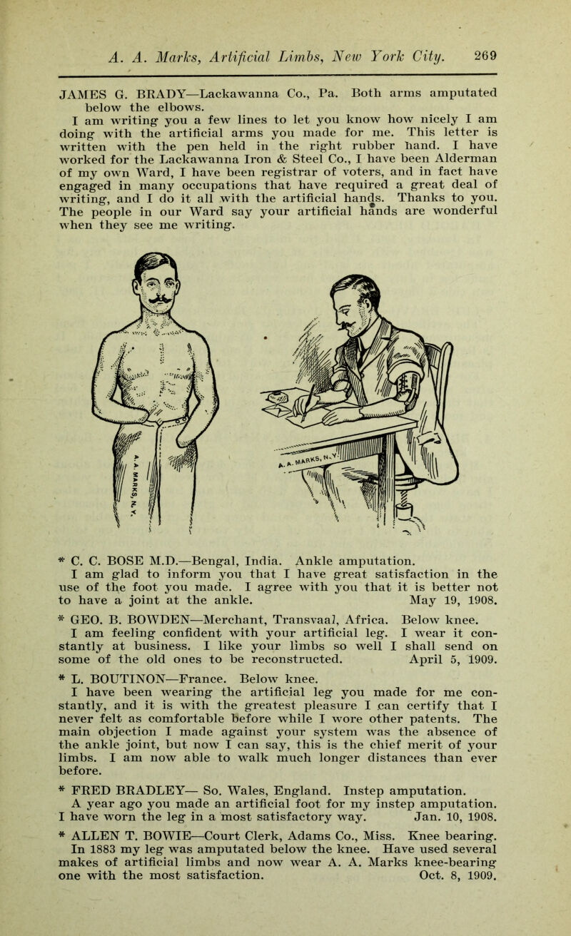 JAMES G. BEADY—Lackawanna Co., Pa. Both arms amputated below the elbows. I am writing- you a few lines to let you know how nicely I am doing with the artificial arms you made for me. This letter is written with the pen held in the right rubber hand. I have worked for the Lackawanna Iron & Steel Co., I have been Alderman of my own Ward, I have been registrar of voters, and in fact have engaged in many occupations that have required a great deal of writing, and I do it all with the artificial hands. Thanks to you. The people in our Ward say your artificial hands are wonderful when they see me writing. * C. C. BOSE M.D.—Bengal, India. Ankle amputation. I am glad to inform you that I have great satisfaction in the use of the foot you made. I agree with you that it is better not to have a joint at the ankle. May 19, 1908. * GEO. B. BOWDEN—Merchant, Transvaal, Africa. Below knee. I am feeling confident with your artificial leg. I wear it con- stantly at business. I like your limbs so well I shall send on some of the old ones to be reconstructed. April 5, 1909. * L. BOUTINON—France. Below knee. I have been wearing the artificial leg you made for me con- stantly, and it is with the greatest pleasure I can certify that I never felt as comfortable before while I wore other patents. The main objection I made against your system was the absence of the ankle joint, but now I can say, this is the chief merit of your limbs. I am now able to walk much longer distances than ever before. * FEED BEADLEY— So. Wales, England. Instep amputation. A year ago you made an artificial foot for my instep amputation. I have worn the leg in a most satisfactory way. Jan. 10, 1908. * ALLEN T. BOWIE—Court Clerk, Adams Co., Miss. Knee bearing. In 1883 my leg was amputated below the knee. Have used several makes of artificial limbs and now wear A. A. Marks knee-bearing one with the most satisfaction. Oct. 8, 1909.