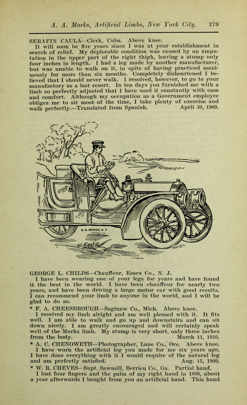 SEKAFIN CAULA—Clerk, Cuba. Above knee. It will soon be five years since I was at your establishment in search of relief. My deplorable condition was caused by an ampu- tation in the upper part of the right thigh, leaving a stump only four inches in length. I had a leg made by another manufacturer, but was unable to walk on it, in spite of having practiced assid- uously for more than six months. Completely disheartened I be- lieved that I should never walk. I resolved, however, to go to your manufactory as a last resort. In ten days you furnished me with a limb so perfectly adjusted that I have used it constantly with ease and comfort. Although my occupation as a Government employee obliges me to sit most of the time, I take plenty of exercise and walk perfectly.—Translated from Spanish. April 30, 1909. GEORGE L. CHILDS—Chauffeur, Essex Co., N. J. I have been wearing one of your legs for years and have found it the best in the world. I have been chauffeur for nearly two years, and have been driving a large motor car with good results. I can recommend your limb to anyone in the world, and I will be glad to do so. * F. A. CHEESBROUGH—Saginaw Co., Mich. Above knee. I received my limb alright and am well pleased with it. It fits well. I am able to walk and go up and downstairs and can sit down nicely. I am greatly encouraged and will certainly speak well of the Marks limb. My stump is very short, only three inches from the body. March 11, 1910. * A. C. CHENOWETH—Photographer, Lane Co.,’ Ore. Above knee. I have worn the artificial leg you made for me six years ago. I have done everything with it I would require of the natural leg and am perfectly satisfied. Aug. 15, 1909. * W. R. CHEVES—Supt. Sawmill, Berrien Co., Ga. Partial hand. I lost four fingers and the palm of my right hand in 1896, about a year afterwards I bought from you an artificial hand. This hand