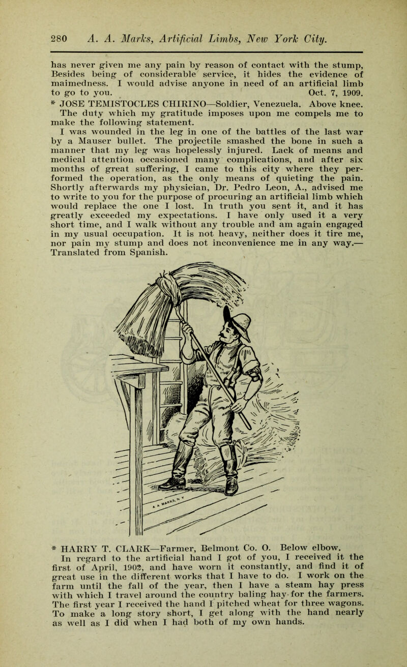 has never g-iven me any pain by reason of contact with the stump, Besides being of considerable service, it hides the evidence of maimedness. I would advise anyone in need of an artificial limb to go to you. ^ Oct. 7, 1909. ^ JOSE TEMISTOCLES CHIRINO—Soldier, Venezuela. Above knee. The duty which my gratitude imposes upon me compels me to make the following statement. I was wounded in the leg in one of the battles of the last war by a Mauser bullet. The projectile smashed the bone in such a manner that my leg was hopelessly injured. Lack of means and medical attention occasioned many complications, and after six months of great suffering, I came to this city where they per- formed the operation, as the only means of quieting the pain. Shortly afterwards my physician. Dr. Pedro Leon, A., advised me to write to you for the purpose of procuring an artificial limb which would replace the one I lost. In truth you sent it, and it has greatly exceeded my expectations. I have only used it a very short time, and I walk without any trouble and am again engaged in my usual occupation. It is not heavy, neither does it tire me, nor pain my stump and does not inconvenience me in any way.— Translated from Spanish. * HARRY T. CLARK—Farmer, Belmont Co. O. Below elbow. In regard to the artificial hand I got of you, I received it the first of April, 190?, and have worn it constantly, and find it of great use in the different works that I have to do. I work on the farm until the fall of the year, then I have a steam hay press with which I travel around the country baling hay for the farmers. The first year I received the hand I pitched wheat for three wagons. To make a long story short, I get along with the hand nearly as well as I did when I had both of my own hands.