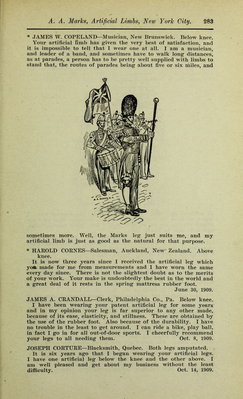 * JAMES W. COPELAND—Musician, New Brunswick. Below knee. Your artificial limb has g-iven the very best of satisfaction, and it is impossible to tell that I wear one at all. I am a musician, and leader of a band, and sometimes have to walk long- distances, as at parades, a person has to be pretty well supplied with limbs to stand that, the routes of parades being- about five or six miles, and sometimes more. Well, the Marks leg just suits me, and my artificial limb is just as good as the natural for that purpose. * HAEOLD CORNES—Salesman, Auckland, New Zealand. Above knee. It is now three years since I received the artificial leg which yoii made for me from measurements and I have worn the same every day since. There is not the slightest doubt as to the merits of your work. Your make is undoubtedly the best in the world and a great deal of it rests in the spring mattress rubber foot. June 30, 1909. JAMES A. CRANDALL—Clerk, Philadelphia Co., Pa. Below knee. I have been wearing your patent artificial leg for some years and in my opinion your leg is far superior to any other made, because of its ease, elasticity, and stillness. These are obtained by the use of the rubber foot. Also because of the durability. I have no trouble in the least to get around. I can ride a bike, play ball, in fact I go in for all out-of-door sports. I cheerfully recommend your legs to all needing them. Oct. 8, 1909. JOSEPH CORTURE—Blacksmith, Quebec. Both legs amputated. It is six years ago that I began wearing your artificial legs. I have one artificial leg below the knee and the other above. I am well pleased and get about my business without the least difficulty. , Oct. 14, 1909.