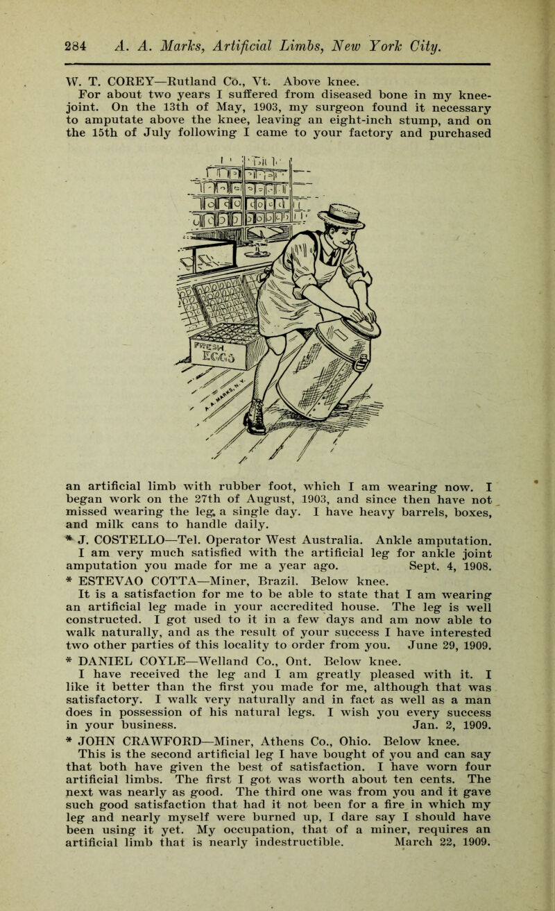 W. T. COREY—Eutland Co., Vt. Above knee. For about t^vo years I suffered from diseased bone in my knee- joint. On the 13th of May, 1903, my surgeon found it necessary to amputate above the knee, leaving an eight-inch stump, and on the 15th of July follovs^ing I came to your factory and purchased an artificial limb w^ith rubber foot, which I am wearing now. I began work on the 27th of August, 1903, and since then have not missed wearing the leg, a single day. I have heavy barrels, boxes, and milk cans to handle daily. ^ J. COSTELLO—Tel. Operator West Australia. Ankle amputation. I am very much satisfied with the artificial leg for ankle joint amputation you made for me a year ago. Sept. 4, 1908. * ESTEVAO COTTA—Miner, Brazil. Below knee. It is a satisfaction for me to be able to state that I am wearing an artificial leg made in your accredited house. The leg is well constructed. I got used to it in a few days and am now able to walk naturally, and as the result of your success I have interested two other parties of this locality to order from you. June 29, 1909. * DANIEL COYLE—Welland Co., Ont. Below knee. I have received the leg and I am greatly pleased with it. I like it better than the first you made for me, although that was satisfactory. I walk very naturally and in fact as well as a man does in possession of his natural legs. I wish you every success in your business. Jan. 2, 1909. * JOHN CRAWFORD—Miner, Athens Co., Ohio. Below knee. This is the second artificial leg I have bought of you and can say that both have given the best of satisfaction. I have worn four artificial limbs. The first I got was worth about ten cents. The next was nearly as good. The third one was from you and it gave such good satisfaction that had it not been for a fire in which my leg and nearly myself were burned up, I dare say I should have been using it yet. My occupation, that of a miner, requires an artificial limb that is nearly indestructible. March 22, 1909.