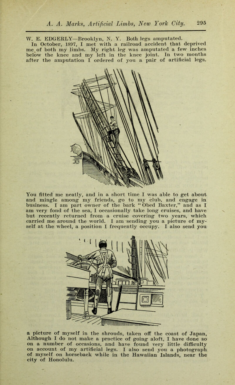 W. E. EDGEELY—Brooklyn, N. Y. Both leg's amputated. In October, 1897, I met with a railroad accident that deprived me^of both my limbs. My right leg was amputated a few inches below the knee and my left in the knee joint. In two months after the amputation I ordered of you a pair of artificial legs. You fitted me neatly, and in a short time I was able to get about and mingle among my friends, go to my club, and engage in business. I am part owner of the bark “ Obed Baxter,” and as I am very fond of the sea, I occasionally take long cruises, and have but recently returned from a cruise covering two years, which carried me around the world. I am sending you a picture of my- self at the wheel, a position I frequently occupy. I also send you a picture of myself in the shrouds, taken off the coast of Japan, Although I do not make a practice of going aloft, I have done so on a number of occasions, and have found very little difficulty on account of my artificial legs. I also send you a photograph of myself on horseback while in the Hawaiian Islands, near the city of Honolulu.