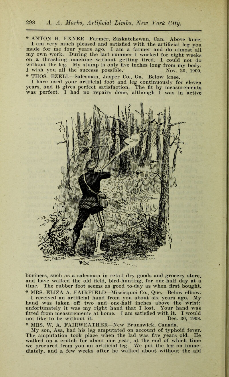 * ANTON H. EXNER—Farmer, Saskatchewan, Can. Above knee. I am very much pleased and satisfied with the artificial leg you made for me four years ago. I am a farmer and do almost all my own work. During the last summer I worked for eight weeks on a thrashing machine without getting tired. I could not do without the leg. My stump is only five inches long from my body. I wish you all the success possible. Nov. 20, 1909. * THOS. EZELL—Salesman, Jasper Co., Ga. Below knee. I have used your artificial foot and leg continuously for eleven years, and it gives perfect satisfaction. The fit by measurements was perfect. I had no repairs done, although I was in active business, such as a salesman in retail dry goods and grocery store, and have walked the old field, bird-hunting, for one-half day at a time. The rubber foot seems as good to-day as when first bought. * MRS. ELIZA A. FAIRFIELD—Missisquoi Co., Que. Below elbow. I received an artificial hand from you about six years ago. My hand was taken off two and one-half inches above the wrist; unfortunately it was my right hand that I lost. Your hand was fitted from measurements at home. I am satisfied with it. I would not like to be without it. Dec. 30, 1908. * MRS. W. A. FAIR WEATHER—New Brunswick, Canada. My son, Asa, had his leg amputated on account of typhoid fever. The amputation took place when the lad was five years old. He walked on a crutch for about one year, at the end of which time we procured from you an artificial leg. We put the leg on imme- diately, and a few weeks after he walked about without the aid