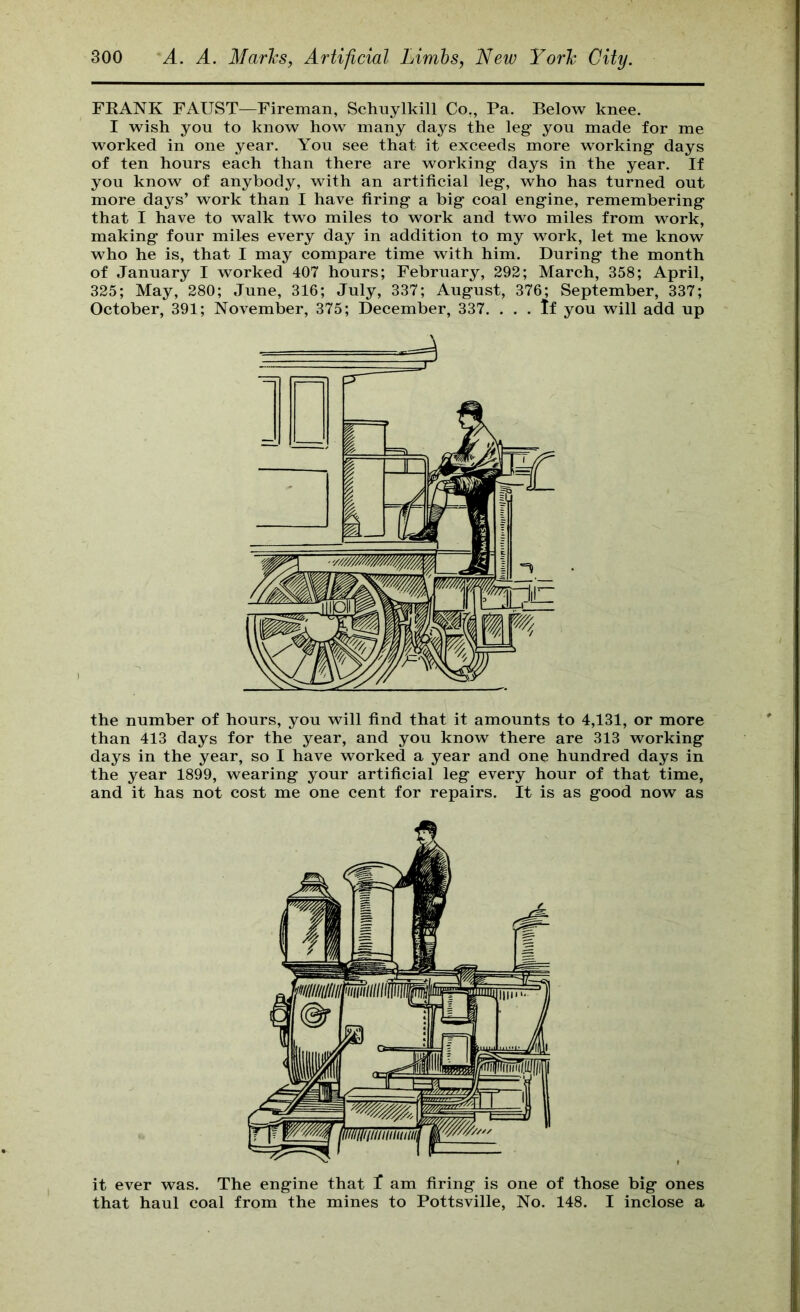 FRANK FAUST—Fireman, Schuylkill Co., Pa. Below knee. I wish you to know how many days the leg you made for me worked in one year. You see that it exceeds more working days of ten hours each than there are working days in the year. If you know of anybody, with an artificial leg, who has turned out more days’ work than I have firing a big coal engine, remembering that I have to walk two miles to work and two miles from work, making four miles every day in addition to my work, let me know who he is, that I may compare time with him. During the month of January I worked 407 hours; February, 292; March, 358; April, 325; May, 280; June, 316; July, 337; August, 376; September, 337; October, 391; November, 375; December, 337. . . . tf you will add up the number of hours, you will find that it amounts to 4,131, or more than 413 days for the year, and you know there are 313 working days in the year, so I have worked a year and one hundred days in the year 1899, wearing your artificial leg every hour of that time, and it has not cost me one cent for repairs. It is as good now as it ever was. The engine that 1 am firing is one of those big ones that haul coal from the mines to Pottsville, No. 148. I inclose a
