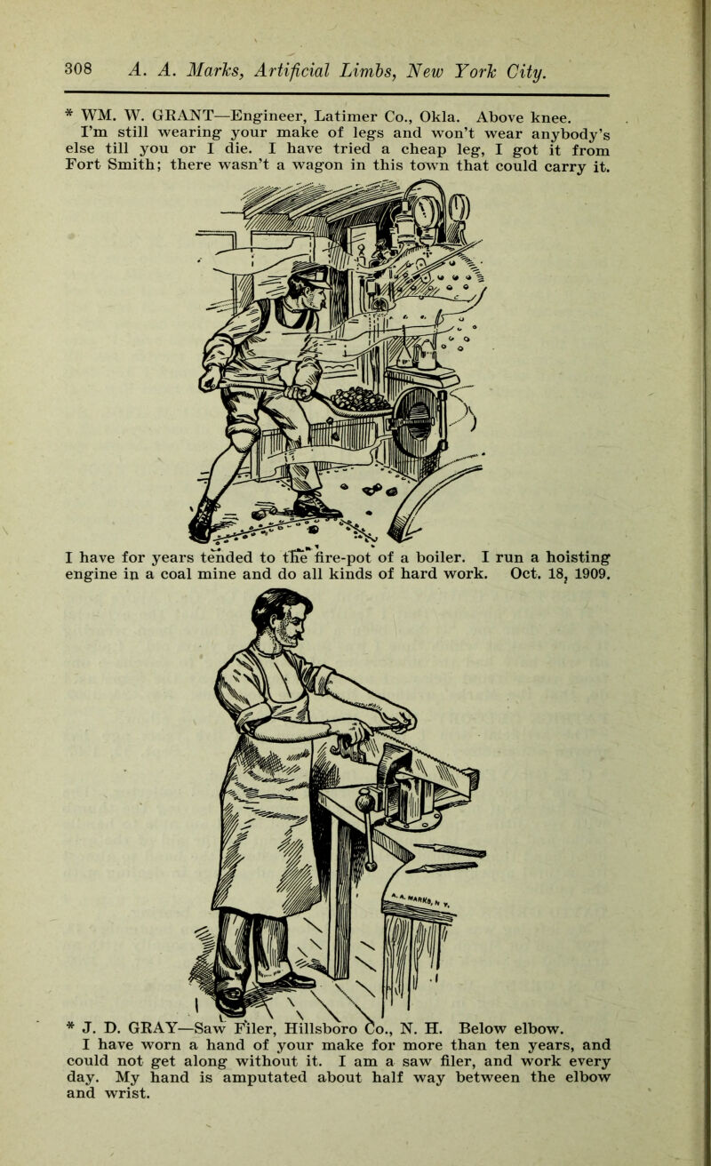 * WM. W. GKANT—Engineer, Latimer Co., Okla. Above knee. I’m still wearing your make of legs and won’t wear anybody’s else till you or I die. I have tried a cheap leg, I got it from Fort Smith; there wasn’t a wagon in this town that could carry it. I have worn a hand of your make for more than ten years, and could not get along without it. I am a saw filer, and work every day. My hand is amputated about half way between the elbow and wrist.
