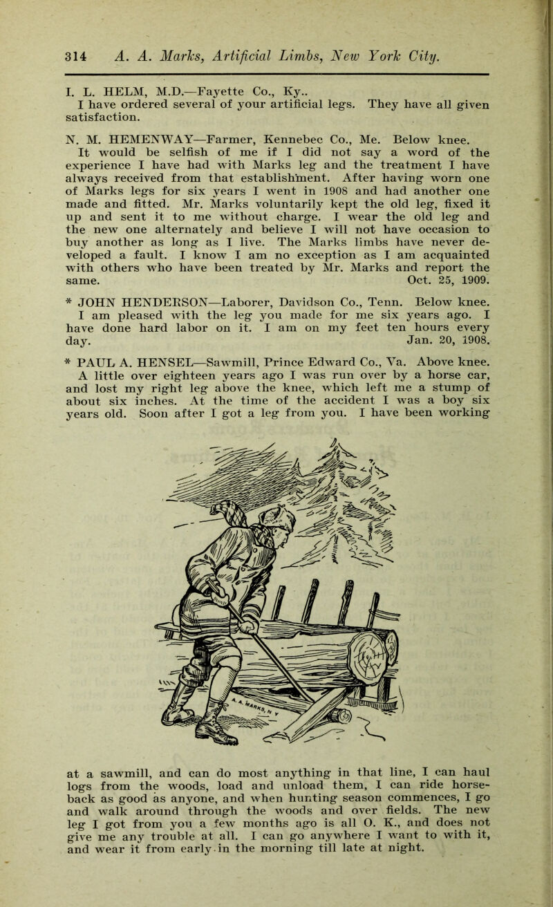 I. L. HELM, M.D.—Fayette Co., Ky.. I have ordered several of your artificial legs. They have all given satisfaction. N. M. HEMENWAY—Farmer, Kennebec Co., Me. Below knee. It would be selfish of me if I did not say a word of the experience I have had with Marks leg and the treatment I have always received from that establishment. After having worn one of Marks legs for six years I went in 1908 and had another one made and fitted. Mr. Marks voluntarily kept the old leg, fixed it up and sent it to me without charge. I wear the old leg and the new one alternately and believe I will not have occasion to buy another as long as I live. The Marks limbs have never de- veloped a fault. I know I am no exception as I am acquainted with others who have been treated by Mr. Marks and report the same. Oct. 25, 1909. * JOHN HENDEESON—Laborer, Davidson Co., Tenn. Below knee. I am pleased with the leg you made for me six years ago. I have done hard labor on it. I am on my feet ten hours every day. Jan. 20, 1908. * PAUL A. HENSEL—Sawmill, Prince Edward Co., Va. Above knee. A little over eighteen years ago I was run over by a horse car, and lost my right leg above the knee, which left me a stump of about six inches. At the time of the accident I was a boy six years old. Soon after I got a leg from you. I have been working at a sawmill, and can do most anything in that line, I can haul logs from the woods, load and unload them, I can ride horse- back as good as anyone, and when hunting season commences, I go and walk around through the woods and over fields. The new leg I got from you a few months ago is all O. K., and does not give me any trouble at all. I can go anywhere I want to with it, and wear it from early-in the morning till late at night.