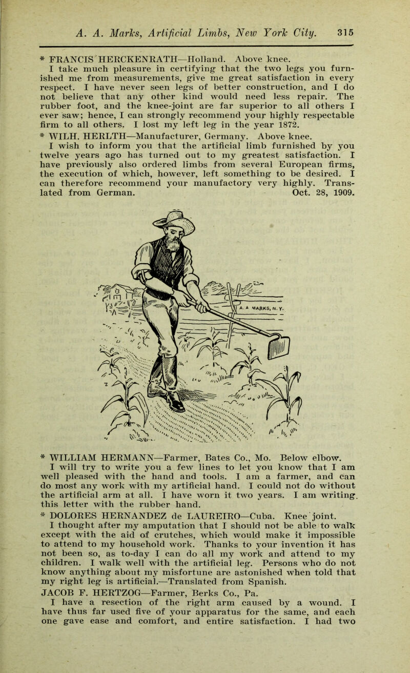 * FEANCIS'HERCKENEATH—Holland. Above knee. I take much pleasure in certifying that the two legs you furn- ished me from measurements, give me great satisfaction in every respect. I have never seen legs of better construction, and I do not believe that any other kind would need less repair. The rubber foot, and the knee-joint are far superior to all others I ever saw; hence, I can strongly recommend youj' highly respectable firm to all others. I lost my left leg in the year 1872. * WILH. HEELTH—Manufacturer, Germany. Above knee. I wish to inform you that the artificial limb furnished by you twelve years ago has turned out to my greatest satisfaction. I have previously also ordered limbs from several European firms, the execution of which, however, left something to be desired. I can therefore recommend your manufactory very highly. Trans- lated from German. Oct. 28, 1909. * WILLIAM HERMANN—Farmer, Bates Co., Mo. Below elbow. I will try to write you a few lines to let you know that I am well pleased with the hand and tools. I am a farmer, and can do most any work with my artificial hand. I could not do without the artificial arm at all. I have worn it two years. I am writing, this letter with the rubber hand. * DOLORES HERNANDEZ de LAUREIRO—Cuba. Knee joint. I thought after my amputation that I should not be able to walk except with the aid of crutches, which would make it impossible to attend to my household work. Thanks to your invention it has not been so, as to-day I can do all my work and attend to my children. I walk well with the artificial leg. Persons who do not know anything about my misfortune are astonished when told that my right leg is artificial.—Translated from Spanish. JACOB F. HERTZOG—Farmer, Berks Co., Pa. I have a resection of the right arm caused by a wound. I have thus far used five of your apparatus for the same, and each one gave ease and comfort, and entire satisfaction. I had two