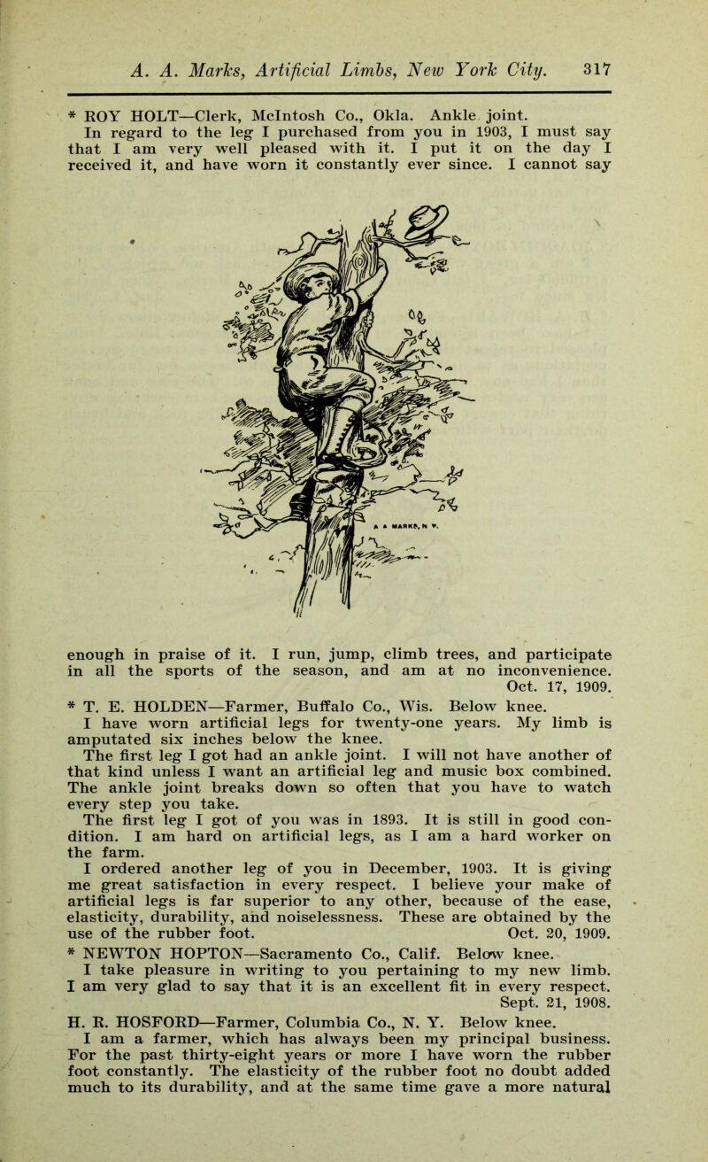 * KOY HOLT—Clerk, McIntosh Co., Okla. Ankle joint. In reg'ard to the leg I purchased from you in 1903, I must say that I am very Avell pleased with it. I put it on the day I received it, and have worn it constantly ever since. I cannot say enough in praise of it. I run, jump, climb trees, and participate in all the sports of the season, and am at no inconvenience. * T. E. HOLDEN—Farmer, Buffalo Co., Wis. Below knee. I have worn artificial legs for twenty-one years. My limb is amputated six inches below the knee. The first leg I got had an ankle joint. I will not have another of that kind unless I want an artificial leg and music box combined. The ankle joint breaks down so often that you have to watch every step you take. The first leg I got of you was in 1893. It is still in good con- dition. I am hard on artificial legs, as I am a hard worker on the farm. I ordered another leg of you in December, 1903. It is giving me great satisfaction in every respect. I believe your make of artificial legs is far superior to any other, because of the ease, elasticity, durability, and noiselessness. These are obtained by the use of the rubber foot. Oct. 20, 1909. * NEWTON HOPTON—Sacramento Co., Calif. Below knee. I take pleasure in writing to you pertaining to my new limb. I am very glad to say that it is an excellent fit in every respect. H. R. HOSFORD—Farmer, Columbia Co., N. Y. Below knee. I am a farmer, which has always been my principal business. For the past thirty-eight years or more I have worn the rubber foot constantly. The elasticity of the rubber foot no doubt added much to its durability, and at the same time gave a more natural \ Oct. 17, 1909.