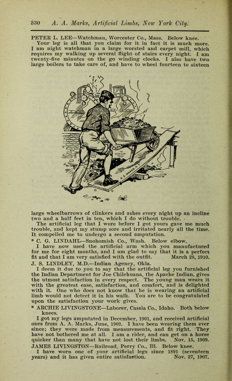 PETEK L. LEE—Watchman, Worcester Co., Mass. Below knee. ' Your leg is all that you claim for it in fact it is much more. I am night watchman in a large worsted and carpet mill, which requires my walking up several flight of stairs every night. I am twenty-five minutes on the go winding clocks. I also have two large boilers to take care of, and have to wheel fourteen to sixteen large wheelbarrows of clinkers and ashes every night up an incline two and a half feet in ten, which I do without trouble. ♦ The artificial leg that I wore before I got yours gave me much trouble, and kept my stump sore and irritated nearly all the time. It compelled me to undergo a second amputation. * C. G. LINDAHL—Snohomish Co., Wash. Below elbow. I have now used the artificial arm which you manufactured for me for eight months, and I am glad to say that it is a perfect fit and that I am very satisfied with the outfit. March 28, 1910. J. S. BINDLEY, M.D.—Indian Agency, Okla. I deem it due to you to say that the artificial leg you furnished the Indian Department for Joe Chilchuana, the Apache Indian, gives the utmost satisfaction in every respect. The young man wears it with the greatest ease, satisfaction, and comfort, and is delighted with it. One who does not know that he is wearing an artificial limb would not detect it in his walk. You are to be congratulated upon the satisfaction your work gives. * ARCHIE LIVINGSTONE—Laborer, Cassia Co., Idaho. Both below knees. I got my legs amputated in December, 1901, and received artificial ones from A. A. Marks, June, 1902. I have been wearing them ever since; they were made from measurements, and fit right. They have not bothered me at all. I am a rider, and can get on a horse quicker than many that have not lost their limbs. Nov. 15, 1909. JAMES LIVINGSTON—Railroad, Perry Co., 111. Below knee. I have worn one of your artificial legs since 1891 (seventeen