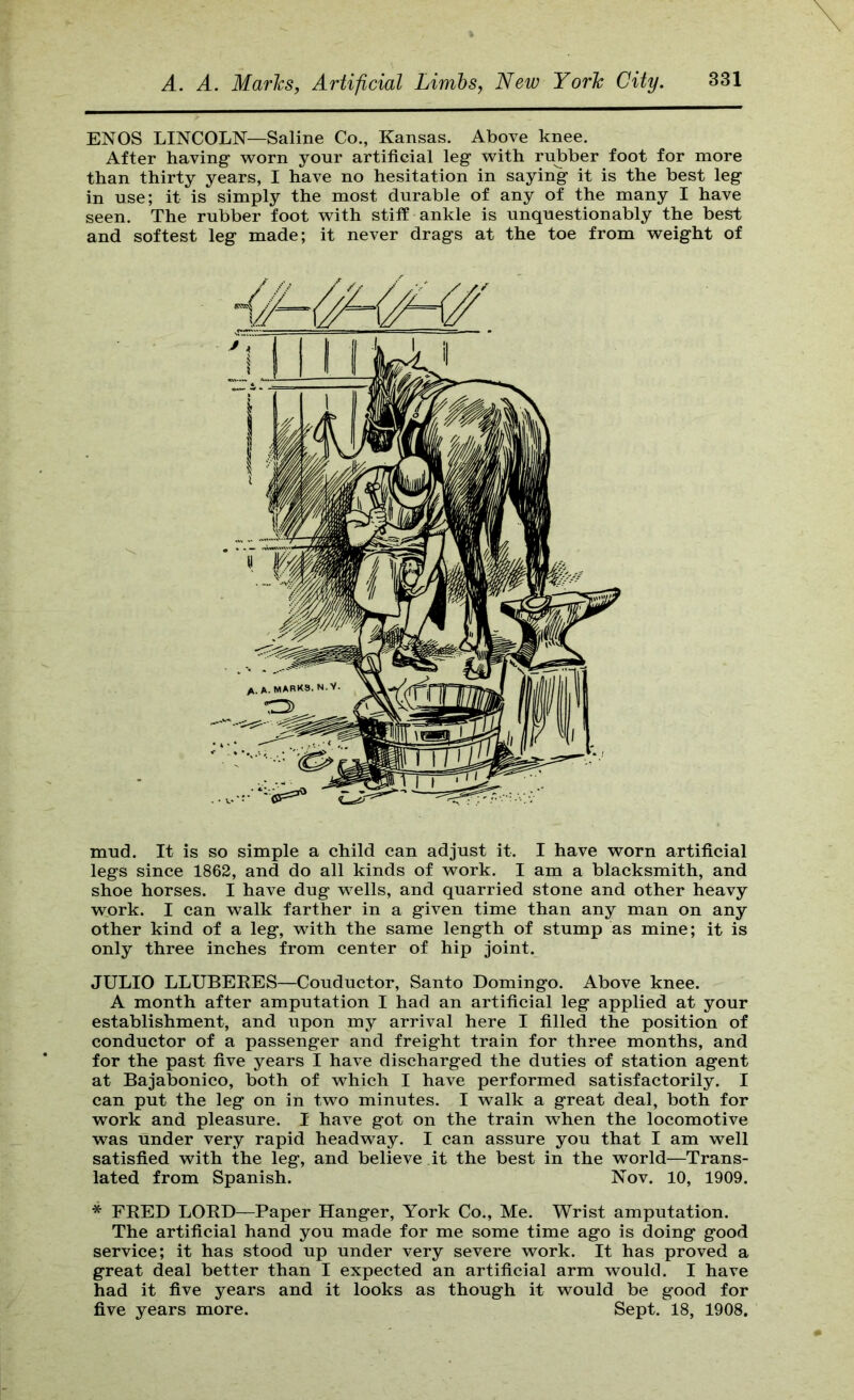 ENOS LINCOLN—Saline Co., Kansas. Above knee. After having ’svorn your artificial leg v^ith rubber foot for more than thirty years, I have no hesitation in saying it is the best leg in use; it is simply the most durable of any of the many I have seen. The rubber foot ^vith stiff ankle is unquestionably the best and softest leg made; it never drags at the toe from weight of mud. It is so simple a child can adjust it. I have worn artificial legs since 1862, and do all kinds of work. I am a blacksmith, and shoe horses. I have dug wells, and quarried stone and other heavy work. I can walk farther in a given time than any man on any other kind of a leg, with the same length of stump as mine; it is only three inches from center of hip joint. JULIO LLUBEEES—Conductor, Santo Domingo. Above knee. A month after amputation I had an artificial leg applied at your establishment, and upon my arrival here I filled the position of conductor of a passenger and freight train for three months, and for the past five years I have discharged the duties of station agent at Bajabonico, both of which I have performed satisfactorily. I can put the leg on in two minutes. I walk a great deal, both for work and pleasure. I have got on the train when the locomotive was under very rapid headway. I can assure you that I am well satisfied with the leg, and believe it the best in the world—Trans- lated from Spanish. Nov. 10, 1909. * FEED LOED—Paper Hanger, York Co., Me. Wrist amputation. The artificial hand you made for me some time ago is doing good service; it has stood up under very severe work. It has proved a great deal better than I expected an artificial arm would. I have had it five years and it looks as though it would be good for five years more. Sept. 18, 1908.