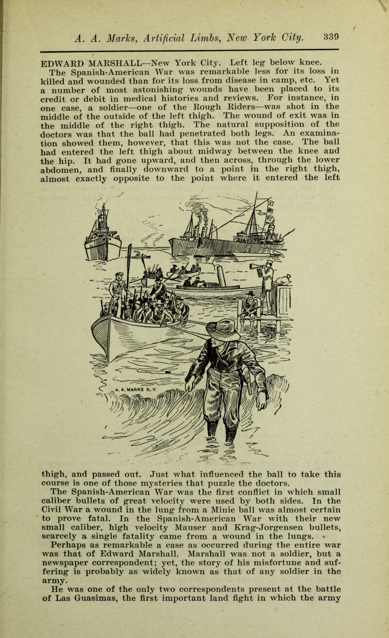 EDWARD MARSHALL—New York City. Left leg below knee. The Spanish-American War was remarkable less for its loss in killed and wounded than for its loss from disease in camp, etc. Yet a number of most astonishing wounds have been placed to its credit or debit in medical histories and reviews. For instance, in one case, a soldier—one of the Rough Riders—was shot in the middle of the outside of the left thigh. The wound of exit was in the middle of the right thigh. The natural supposition of the doctors was that the ball had penetrated both legs. An examina- tion showed them, however, that this was not the case. The ball had entered the left thigh about midway between the knee and the hip. It had gone upward, and then across, through the lower abdomen, and finally downward to a point in the right thigh, almost exactly opposite to the point where it entered the left thigh, and passed out. Just what influenced the ball to take this course is one of those mysteries that puzzle the doctors. The Spanish-American War was the first conflict in which small caliber bullets of great velocity were used by both sides. In the Civil War a wound in the lung from a Minie ball was almost certain to prove fatal. In the Spanish-American War with their new small caliber, high velocity Mauser and Krag-Jorgensen bullets, scarcely a single fatality came from a wound in the lungs. • Perhaps as remarkable a case as occurred during the entire war was that of Edward Marshall. Marshall was not a soldier, but a newspaper correspondent; yet, the story of his misfortune and suf- fering is probably as widely known as that of any soldier in the army. He was one of the only two correspondents present at the battle of Las Guasimas, the first important land fight in which the army