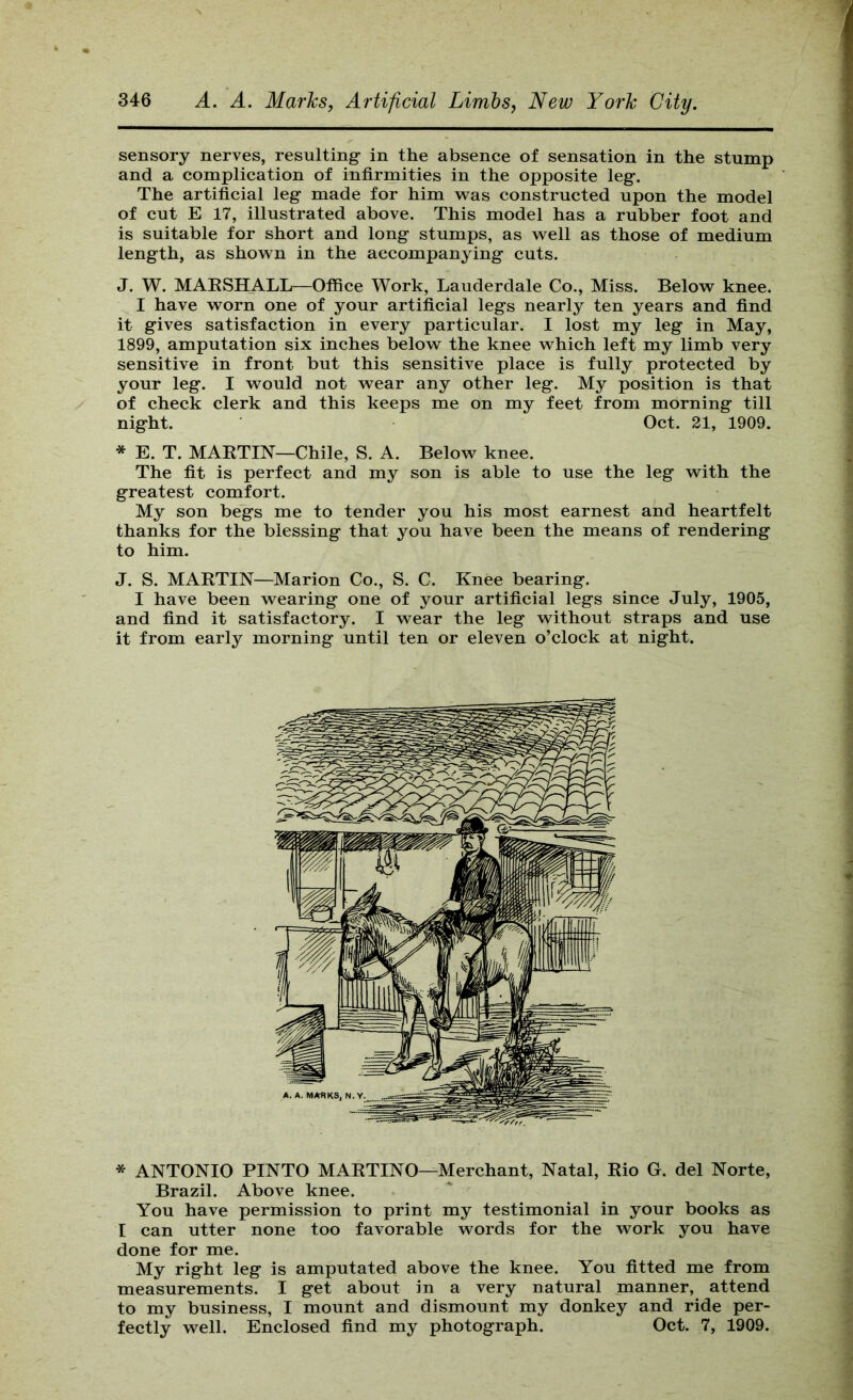 sensory nerves, resulting in the absence of sensation in the stump and a complication of infirmities in the opposite leg. The artificial leg made for him was constructed upon the model of cut E 17, illustrated above. This model has a rubber foot and is suitable for short and long stumps, as well as those of medium length, as shown in the accompanying cuts. J. W. MAESHALL—Office Work, Lauderdale Co., Miss. Below knee. I have worn one of your artificial legs nearly ten years and find it gives satisfaction in every particular. I lost my leg in May, 1899, amputation six inches below the knee which left my limb very sensitive in front but this sensitive place is fully protected by your leg. I would not wear any other leg. My position is that of check clerk and this keeps me on my feet from morning till night. Oct. 21, 1909. * E. T. MAETIN—Chile, S. A. Below knee. The fit is perfect and my son is able to use the leg with the greatest comfort. My son begs me to tender you his most earnest and heartfelt thanks for the blessing that you have been the means of rendering to him. J. S. MAETIN—Marion Co., S. C. Knee bearing. I have been wearing one of your artificial legs since July, 1905, and find it satisfactory. I wear the leg without straps and use it from early morning until ten or eleven o’clock at night. * ANTONIO PINTO MAETINO—Merchant, Natal, Eio G. del Norte, Brazil. Above knee. You have permission to print my testimonial in your books as I can utter none too favorable words for the work you have done for me. My right leg is amputated above the knee. You fitted me from measurements. I get about in a very natural manner, attend to my business, I mount and dismount my donkey and ride per- fectly well. Enclosed find my photograph. Oct. 7, 1909.