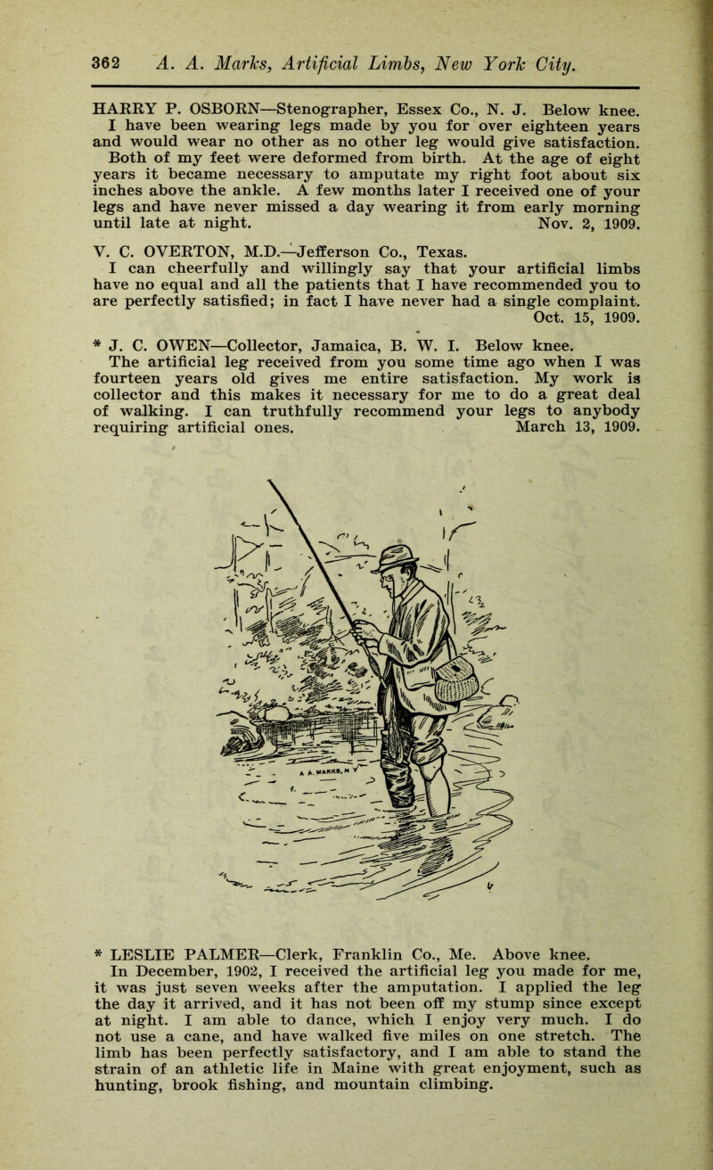 HAERY P. OSBORN—Stenographer, Essex Co., N. J. Below knee. I have been wearing legs made by you for over eighteen years and would wear no other as no other leg would give satisfaction. Both of my feet were deformed from birth. At the age of eight years it became necessary to amputate my right foot about six inches above the ankle. A few months later I received one of your legs and have never missed a day wearing it from early morning until late at night. Nov. 3, 1909. V. C. OVERTON, M.D.—Jefferson Co., Texas. I can cheerfully and willingly say that your artificial limbs have no equal and all the patients that I have recommended you to are perfectly satisfied; in fact I have never had a single complaint. Oct. 15, 1909. * J. C. OWEN—Collector, Jamaica, B. W. I. Below knee. The artificial leg received from you some time ago when I was fourteen years old gives me entire satisfaction. My work is collector and this makes it necessary for me to do a great deal of walking. I can truthfully recommend your legs to anybody requiring artificial ones. March 13, 1909. * LESLIE PALMER—Clerk, Franklin Co., Me. Above knee. In December, 1902, I received the artificial leg you made for me, it was just seven weeks after the amputation. I applied the leg the day it arrived, and it has not been off my stump since except at night. I am able to dance, which I enjoy very much. I do not use a cane, and have walked five miles on one stretch. The limb has been perfectly satisfactory, and I am able to stand the strain of an athletic life in Maine with great enjoyment, such as hunting, brook fishing, and mountain climbing.