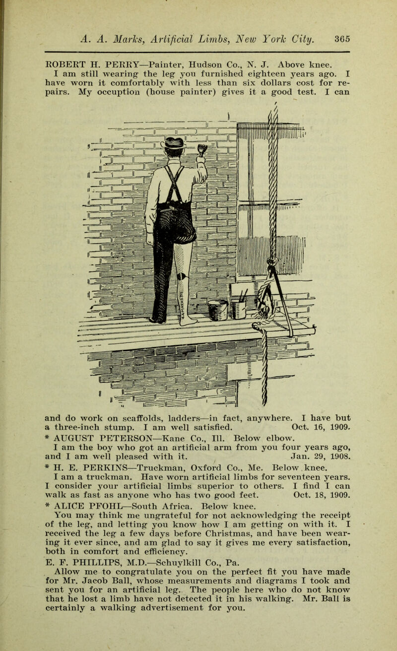 ROBERT H. PERRY—Painter, Hudson Co., N. J. Above knee. I am still vrearing- the leg you furnished eighteen years ago. I have worn it comfortably with less than six dollars cost for re- pairs. My occuption (house painter) gives it a good test. I can and do work on scaffolds, ladders—in fact, anywhere. I have but a three-inch stump. I am well satisfied. Oct. 16, 1909. * AUGUST PETERSON—Kane Co., 111. Below elbow. I am the boy who got an artificial arm from you four years ago, and I am well pleased with it. Jan. 29, 1908. * H. E. PERKINS—Truckman, Oxford Co., Me. Below , knee. I am a truckman. Have worn artificial limbs for seventeen years. I consider your artificial limbs superior to others. I find I can walk as fast as anyone who has two good feet. Oct. 18, 1909. * ALICE PFOHI^South Africa. Below knee. You may think me ungrateful for not acknowledging the receipt of the leg, and letting you know how I am getting on with it. I received the leg a few days before Christmas, and have been wear- ing it ever since, and am glad to say it gives me every satisfaction, both in comfort and efficiency. E. F. PHILLIPS, M.D.—Schuylkill Co., Pa. Allow me to congratulate you on the perfect fit you have made for Mr. Jacob Ball, whose measurements and diagrams I took and sent you for an artificial leg. The people here who do not know that he lost a limb have not detected it in his walking. Mr. Ball is certainly a walking advertisement for you.
