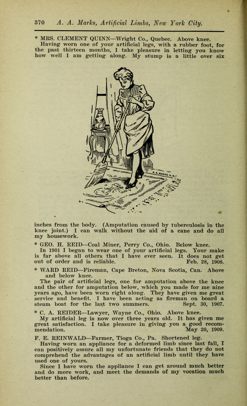 * MRS. CLEMENT QUINN—Wright Co., Quebec. Above knee. Having w^orn one of your artificial legs, with a rubber foot, for the past thirteen months, I take pleasure in letting you know how well I am getting along. My stump is a little over six inches from the body. (Amputation caused by tuberculosis in the knee joint.) I can walk without the aid of a cane and do all my housework. * GEO. H. REID—Coal Miner, Perry Co., Ohio. Below knee. In 1901 I began to wear one of your artificial legs. Your make is far above all others that I have ever seen. It does not get out of order and is reliable. Feb. 28, 1908. * WARD REID—Fireman, Cape Breton, Nova Scotia, Can. Above and below knee. The pair of artificial legs, one for amputation above the knee and the other for amputation below, which you made for me nine years ago, have been worn right along. They have given me great service and benefit. I have been acting as fireman on board a steam boat for the last two summers. Sept. 30, 1907. ^ C. A. REIDER—Lawyer, Wayne Co., Ohio. Above knee. My artificial leg is now over three years old. It has given me great satisfaction. I take pleasure in giving you a good recom- mendation. May 20, 1909. F. E. REIN WALD—Farmer, Tioga Co., Pa. Shortened leg. Having worn an appliance for a deformed limb since last fall, I can positively assure all my unfortunate friends that they do not comprehend the advantages of an artificial limb until they have used one of yours. Since I have worn the appliance I can get around much better and do more work, and meet the demands of my vocation much better than before.