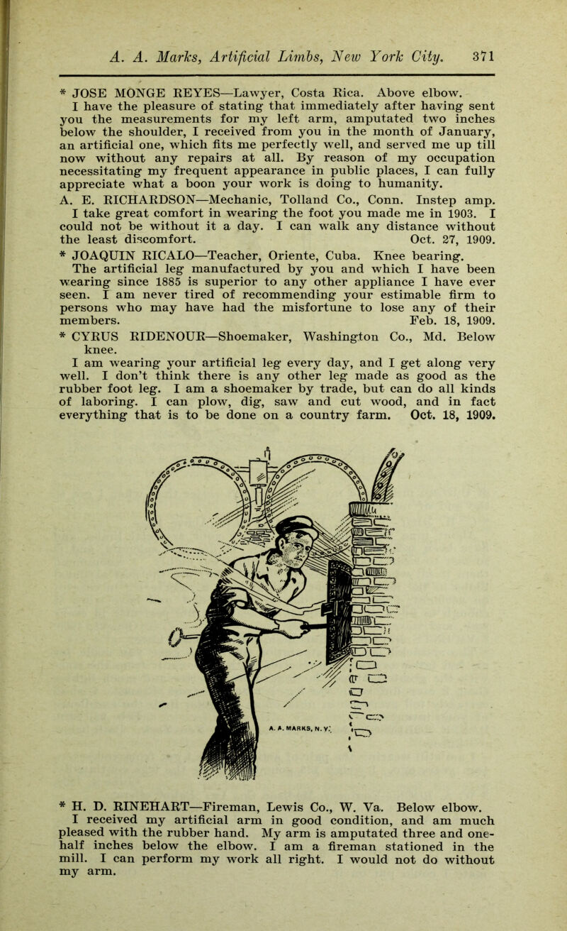 * JOSE MONGE KEYES—Lawyer, Costa Rica. Above elbow. I have the pleasure of stating that immediately after having sent you the measurements for my left arm, amputated two inches below the shoulder, I received from you in the month of January, an artificial one, which fits me perfectly well, and served me up till now without any repairs at all. By reason of my occupation necessitating my frequent appearance in public places, I can fully appreciate what a boon your work is doing to humanity. A. E. RICHARDSON—Mechanic, Tolland Co., Conn. Instep amp. I take great comfort in wearing the foot you made me in 1903. I could not be without it a day. I can walk any distance without the least discomfort. Oct. 27, 1909. * JOAQUIN RICALO—Teacher, Oriente, Cuba. Knee bearing. The artificial leg manufactured by you and which I have been wearing since 1885 is superior to any other appliance I have ever seen. I am never tired of recommending your estimable firm to persons who may have had the misfortune to lose any of their members. Feb. 18, 1909. * CYRUS RIDENOUR—Shoemaker, Washington Co., Md. Below knee. I am wearing your artificial leg every day, and I get along very well. I don’t think there is any other leg made as good as the rubber foot leg. I am a shoemaker by trade, but can do all kinds of laboring. I can plow, dig, saw and cut wood, and in fact everything that is to be done on a country farm. Oct. 18, 1909. * H. D. RINEHART—Fireman, Lewis Co., W. Va. Below elbow. I received my artificial arm in good condition, and am much pleased with the rubber hand. My arm is amputated three and one- half inches below the elbow. I am a fireman stationed in the mill. I can perform my work all right. I would not do without my arm.