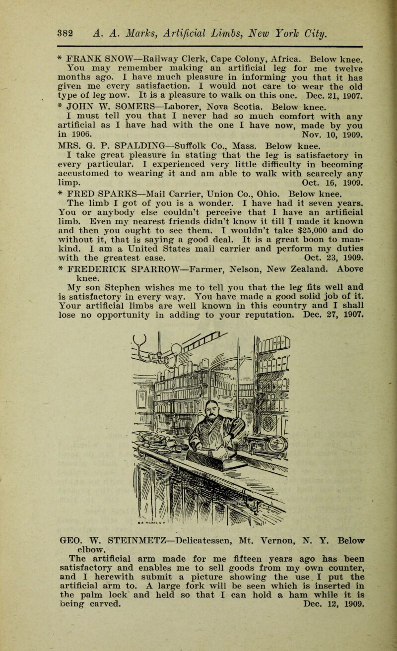 * FKANK SNOW—Eailway Clerk, Cape Colony, Africa. Below knee. You may remember making an artificial leg for me twelve months ago. I have much pleasure in informing you that it has given me every satisfaction. I would not care to wear the old type of leg now. It is a pleasure to walk on this one. Dec. 21, 1907. * JOHN W. SOMEKS—Laborer, Nova Scotia. Below knee. I must tell you that I never had so much comfort with any artificial as I have had with the one I have now, made by you in 1906. Nov. 10, 1909. MRS. G. P. SPALDING—Suffolk Co., Mass. Below knee. I take great pleasure in stating that the leg is satisfactory in every particular. I experienced very little difficulty in becoming accustomed to wearing it and am able to walk with scarcely any limp. Oct. 16, 1909. * FRED SPARKS—Mail Carrier, Union Co., Ohio. Below knee. The limb I got of you is a wonder. I have had it seven years. You or anybody else couldn’t perceive that I have an artificial limb. Even my nearest friends didn’t know it till I made it known and then you ought to see them. I wouldn’t take $25,000 and do without it, that is saying a good deal. It is a great boon to man- kind. I am a United States mail carrier and perform my duties with the greatest ease. Oct. 23, 1909. * FREDERICK SPARROW—Farmer, Nelson, New Zealand. Above knee. My son Stephen wishes me to tell you that the leg fits well and is satisfactory in every way. You have made a good solid job of it. Your artificial limbs are well known in this country and I shall lose no opportunity in adding to your reputation. Dec. 27, 1907. GEO. W. STEINMETZ—Delicatessen, Mt. Vernon, N. Y. Below elbow. The artificial arm made for me fifteen years ago has been satisfactory and enables me to sell goods from my own counter, and I herewith submit a picture showing the use I put the artificial arm to. A large fork will be seen which is inserted in the palm lock and held so that I can hold a ham while it is being carved. Dec. 12, 1909.