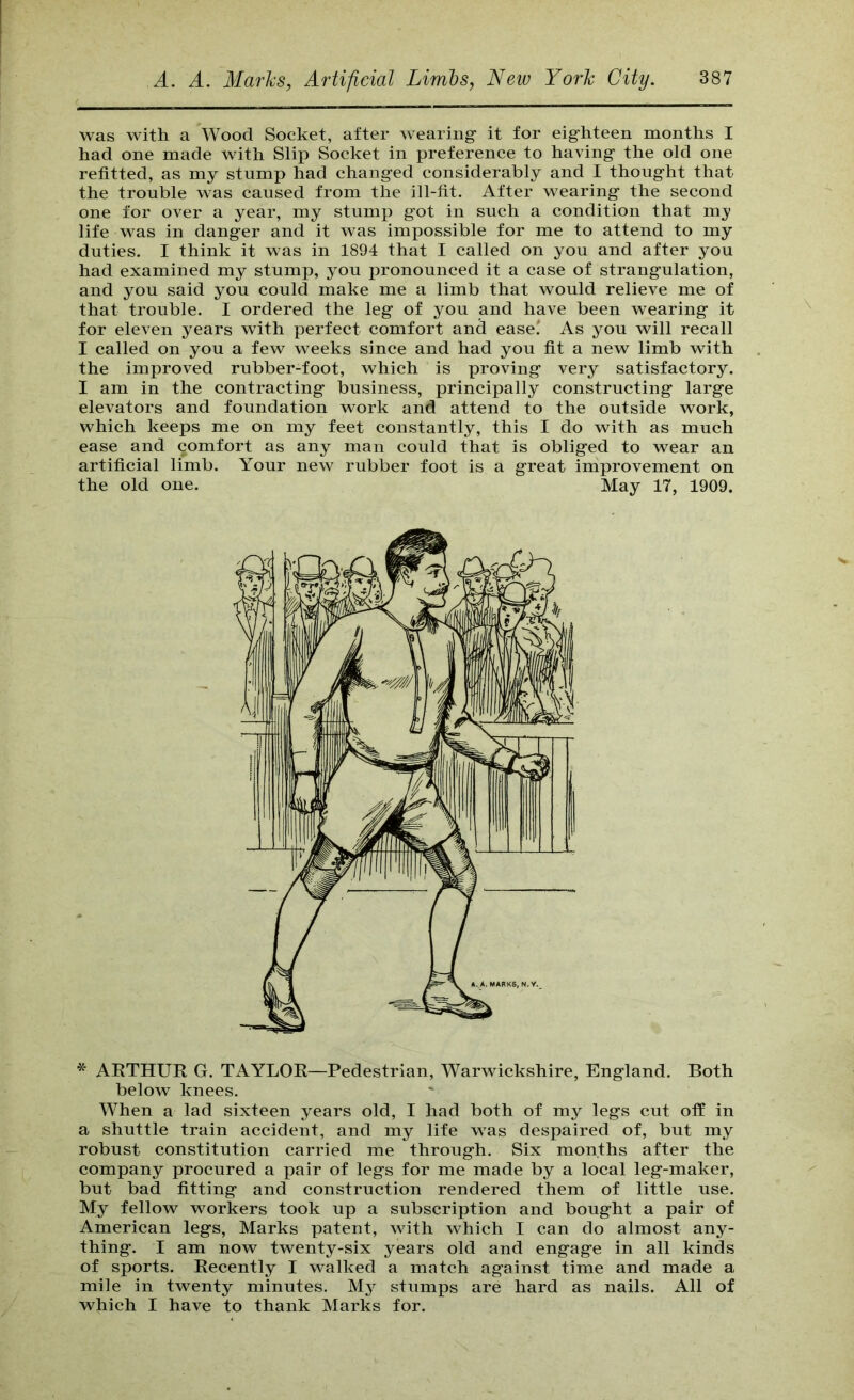 was with a Wood Socket, after wearing it for eighteen months I had one made with Slip Soeket in preference to having the old one refitted, as my stump had changed considerably and I thought that the trouble was caused from the ill-fit. After wearing the second one for over a year, my stump got in such a condition that my life was in danger and it was impossible for me to attend to my duties. I think it was in 1894 that I called on you and after you had examined my stump, you pronounced it a case of strangulation, and you said you could make me a limb that would relieve me of that trouble. I ordered the leg of you and have been wearing it for eleven years with perfect comfort and ease' As you will recall I called on you a few weeks since and had you fit a new limb with the improved rubber-foot, which is proving very satisfactory. I am in the contracting business, principally constructing large elevators and foundation work and attend to the outside work, which keeps me on my feet constantly, this I do with as much ease and comfort as any man could that is obliged to wear an artificial limb. Your new rubber foot is a great iniprovement on the old one. May 17, 1909. * ARTHUR G. TAYLOR—Pedestrian, Warwickshire, England. Both below knees. When a lad sixteen years old, I had both of my legs cut off in a shuttle train aecident, and my life was despaired of, but my robust constitution carried me through. Six months after the company procured a pair of legs for me made by a local leg-maker, but bad fitting and construction rendered them of little use. My fellow workers took up a subscription and bought a pair of American legs, Marks patent, with whieh I ean do almost any- thing. I am now twenty-six years old and engage in all kinds of sports. Recently I walked a match against time and made a mile in twenty minutes. My stumps are hard as nails. All of which I have to thank Marks for.