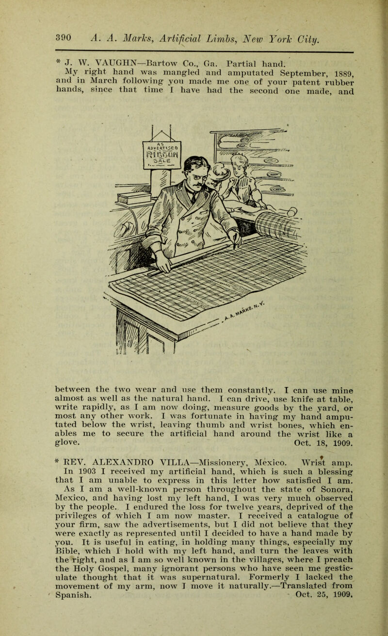 * J. W. VAUGHN—Bartow Co., Ga. Partial hand. My rig-ht hand was mang-led and amputated September, 1889, and in March following you made me one of your patent rubber hands, since that time I have had the second one made, and between the two wear and use them constantly. I can use mine almost as well as the natural hand. I can drive, use knife at table, write rapidly, as I am now doing, measure goods by the yard, or most any other work. I was fortunate in having my hand ampu- tated below the wrist, leaving thumb and wrist bones, which en- ables me to secure the artificial hand around the wrist like a glove. Oct. 18, 1909. * REV. ALEXANDRO VILLA—Missionery, Mexico. Wri^t amp. In 1903 I received my artificial hand, which is such a blessing that I am unable to express in this letter how satisfied I am. As I am a well-known person throughout the state of Sonora, Mexico, and having lost my left hand, I was very much observed by the people. I endured the loss for twelve years, deprived of the privileges of which I am now master. I received a catalogue of your firm, saw the advertisements, but I did not believe that they were exactly as represented until I decided to have a hand made by you. It is useful in eating, in holding many things, especially my Bible, which I hold with my left hand, and turn the leaves with the right, and as I am so well known in the villages, where I preach the Holy Gospel, many ignorant persons who have seen me gestic- ulate thought that it was supernatural. Formerly I lacked the movement of my arm, now I move it naturally.—Translated from Spanish. Oct. 25, 1909,