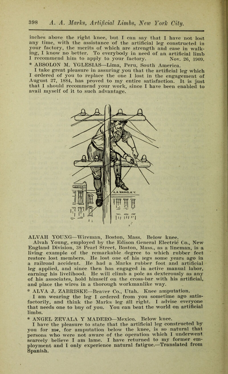 inches above the right knee, bnt I can say that I have not lost any time, with the assistance of the artificial leg constructed in your factory, the merits of which are strength and ease in walk- ing, I know no better. To everybody in need of an artificial limb I recommend him to apply to your factory. Nov. 26, 1909. * ABSOLON M. YGLESIAS—Lima, Peru, South America. I take great pleasure in assuring you that the artificial leg which I ordered of you to replace the one I lost in the engagement of August 27, 1884, has proved to my entire satisfaction. It is just that I should recommend your work, since I have been enabled to avail myself of it to such advantage. ALVAH YOUNG—Wireman, Boston, Mass. Below knee. Alvah Young, employed by the Edison General Electric Co., New England Division, 38 Pearl Street, Boston, Mass., as a lineman, is a living example of the remarkable degree to which rubber feet restore lost members. He lost one of his legs some years ago in a railroad accident. He had a Marks rubber foot and artificial leg applied, and since then has engaged in active manual labor, earning his livelihood. He will climb a pole as dexterously as any of his associates, hold himself on the cross-bar with his artificial, and place the wires in a thorough workmanlike way. * ALVA J. ZABRISKE—Beaver Co., Utah. Knee amputation. I am wearing the leg I ordered from you sometime ago satis- factorily, and think the Marks leg all right. I advise everyone that needs one to buy of you. You can beat the world on artificial limbs. * ANGEL ZEVALA Y MADERO—Mexico. Below knee. I have the pleasure to state that the artificial leg constructed by you for me, for amputation below the knee, is so natural that persons who were not aware of the operation which I underwent scarcely believe I am lame. I have returned to my former em- ployment and I only experience natural fatigue.—Translated from Spanish.