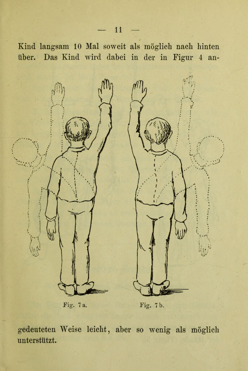 Kind langsam 10 Mal soweit als möglich nach hinten über. Das Kind wird dabei in der in Figur 4 an- gedeuteten Weise leicht, unterstützt. aber so wenig als möglich