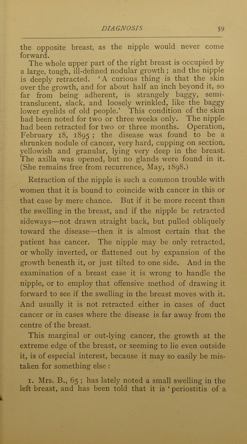 the opposite breast, as the nipple would never come forward. The whole upper part of the right breast is occupied by a large, tough, ill-defined nodular growth; and the nipple is deeply retracted. * A curious thing is that the skin over the growth, and for about half an inch beyond it, so far from being adherent, is strangely baggy, semi- translucent, slack, and loosely wrinkled, like the baggy lower eyelids of old people.’ This condition of the skin had been noted for two or three weeks only. The nipple had been retracted for two or three months. Operation, February 18, 1895 ; the disease was found to be a shrunken nodule of cancer, very hard, cupping on section, yellowish and granular, lying very deep in the breast. The axilla was opened, but no glands were found in it. (She remains free from recurrence, May, 1898.) Retraction of the nipple is such a common trouble with women that it is bound to coincide with cancer in this or that case by mere chance. But if it be more recent than the swelling in the breast, and if the nipple be retracted sideways—not drawn straight back, but pulled obliquely toward the disease—then it is almost certain that the patient has cancer. The nipple may be only retracted, or wholly inverted, or flattened out by expansion of the growth beneath it, or just tilted to one side. And in the examination of a breast case it is wrong to handle the nipple, or to employ that offensive method of drawing it forward to see if the swelling in the breast moves with it. And usually it is not retracted either in cases of duct cancer or in cases where the disease is far away from the centre of the breast. This marginal or out-lying cancer, the growth at the extreme edge of the breast, or seeming to lie even outside it, is of especial interest, because it may so easily be mis- taken for something else : 1. Mrs. B., 65 ; has lately noted a small swelling in the left breast, and has been told that it is ‘ periostitis of a