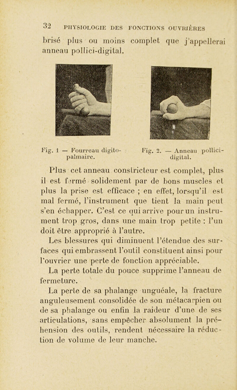 brisé plus ou moins complet que j'appellerai anneau pollici-digital. Plus cet anneau constricteur est complet, plus il est fermé solidement par de bons muscles et plus la prise est efficace ; en effet, lorsqu’il est mal fermé, l’instrument que tient la main peut s’en échapper. C’est ce qui arrive pour un instru- ment trop gros, dans une main trop petite : l’un doit être approprié à l’autre. Les blessures qui diminuent l’étendue des sur- faces qui embrassent l’outil constituent ainsi pour l’ouvrier une perte de fonction appréciable. La perte totale du pouce supprime l’anneau de fermeture. La perte de sa phalange unguéale, la fracture anguleusement consolidée de son métacarpien ou de sa phalange ou enfin la raideur d’une de ses articulations, sans empêcher absolument la pré- hension des outils, rendent nécessaire la réduc- tion de volume de leur manche. Fig-. 1 — Fourreau digito- palmaire. Fig. 2. — Anneau pollici- digital.