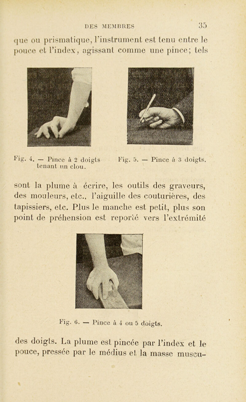 que ou prismatique, l'instrument est tenu entre le pouce et l’index, agissant comme une pince; tels sont la plume à écrire, les outils des graveurs, des mouleurs, etc., l’aiguille des couturières, des tapissiers, etc. Plus le manche est petit, plus son point de préhension est reporté vers l’extrémité Fig’. 6. — Pince à 4 ou 5 doigts. des doigts. La plume est pincée par l’index et le pouce, pressée par le médius et la masse muscu-