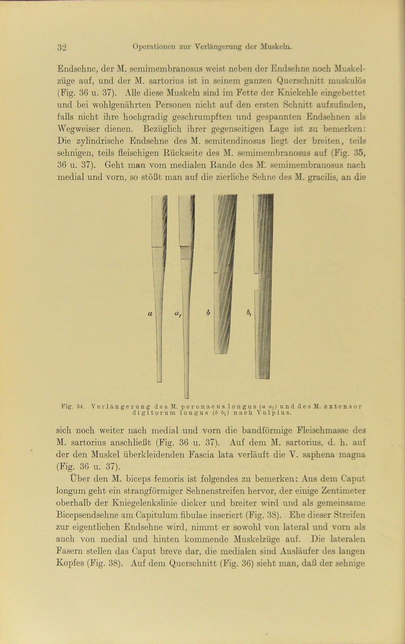 Endseliuc, der M. semimembranosus weist neben der Endsehne noch Muskel- züge auf, und der M. sartorius ist in seinem ganzen Querschnitt muskulös (Fig. 36 u. 37). Alle diese Muskeln sind im Fette der Kniekehle eingebettet und bei wohlgenährten Personen nicht auf den ersten Schnitt aufzufinden, falls nicht ihre hochgradig geschrumpften und ge.spannten Endsehnen als Wegweiser dienen. Bezüglich ihrer gegenseitigen Lage ist zu bemerken: Die zylindrische Endsehne des M. semitendino.sus liegt der breiten, teils sehnigen, teils fleischigen Rückseite des M. semimembranosus auf (Fig. 35, 36 u. 37). Geht man vom medialen Rande des M. semimembranosus nach medial und vorn, so stößt man auf die zierliche Sehne des M. gracilis, an die Fig. 34. Verlängerung des M. peronaeus longus (a 0|) und des M. extensor digitorum longus (b hi) nach Vulpius. sich noch weiter nach medial und vorn die bandförmige Fleischmasse des M. sartorius anschheßt (Fig. 36 u. 37). Auf dem M. sartorius, d. h. auf der den Muskel überkleidenden Fascia lata verläuft die V. saphena magna (Fig. 36 u. 37). Über den M. biceps femoris ist folgendes zu bemerken: Aus dem Caput longum geht ein strangförmiger Sehnenstreifen hervor, der einige Zentimeter oberhalb der Kniegelenkshnie dicker und breiter wird und als gemeinsame Bicepsendsehne am Capitulum fibulae inseriert (Fig. 38). Ehe dieser Streifen zur eigenthchen Endsehne wird, nimmt er sowohl von lateral und vorn als auch von medial und hinten kommende Muskelzüge auf. Die lateralen Fasern stellen das Caput breve dar, die medialen sind Ausläufer des laugen Kopfes (Fig. 38). Auf dem Querschnitt (Fig. 36) sieht man, daß der sehnige