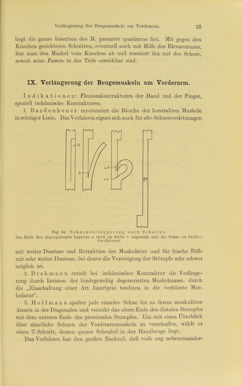 liegt die ganze Insertion des M. pronator quadratus frei. Mit gegen den Knochen gerichteten Schnitten, eventuell auch mit Hilfe des Elevatoriums, löst man den Muskel vom Knochen ab und reseziert ihn mit der Schere, soweit seine Fasern in der Tiefe erreichbar sind. IX. Verlängerung der Beugemuskeln am Vorderarm. Indikationen: Flexionskontrakturen der Hand und der Finger, speziell ischämische Kontrakturen. 1. Barden heuer myotomiert die Bäuche der kontrakten Muskeln in schräger Linie. Das Verfahren eignet sich auch für alte Sehnenverletzungen Fig. 64. S e h n e n V e r 1 il n g e r u n g nach Schnitze. Das Ende des abgespaltenen Lappens a wird an Stelle h angenäht und die Sehne an Stelle c duvchtrennt. mit weiter Diastase und Retraktion der Muskulatur und für frische Fälle mit sehr weiter Diastase, bei denen die Vereinigung der Stümpfe sehr schwer möghch ist. 2. Dreh mann erzielt bei ischämischer Kontraktur die Verlänge- rung durch Inzision der bindegewebig degenerierten Muskehnasse, durch die „Einschaltung einer Art Inscriptio tendinea in die verkürzte Mus- kulatur“. 3. Hoffmann spaltet jede einzelne Sehne bis zu ihrem muskulären Ansatz in der Diagonalen und vernäht das obere Ende des distalen Stumpfes mit dem unteren Ende des proximalen Stumpfes. Um sich einen Überblick über sämthche Sehnen der Vorderarmmuskeln zu verschaffen, wählt er einen T-Schnitt, dessen querer Schenkel in der Handbeuge liegt. Das Verfahren hat den großen Nachteil, daß viele eng nebeneinander-