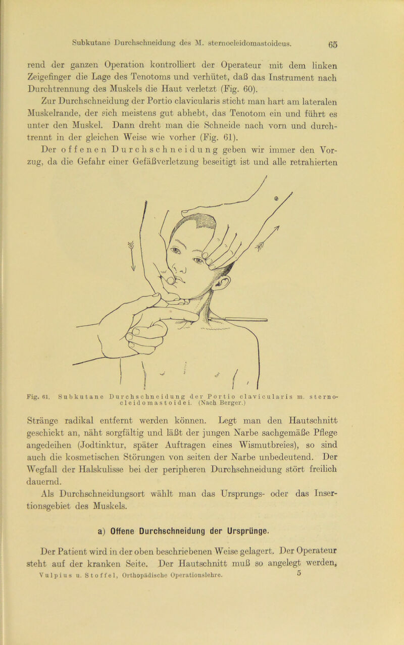 rencl der ganzen Operation kontrolliert der Operateur mit dem linken Zeigefinger die Lage des Teiiotoms und verhütet, daß das Instrument nach Durchtrennung des Muskels die Haut verletzt (Fig. 60). Zur Durchschneidung der Portio clavicularis sticht man hart am lateralen Muskelrande, der sich meistens gut abhebt, das Tenotom ein und führt es unter den Muskel. Dann dreht man die Schneide nach vorn und durch- trennt in der gleichen Weise wie vorher (Fig. 61). Der offenen Durchschneidung geben wir immer den Vor- zug, da die Gefahr einer Gefäßverletzung beseitigt ist und alle retrahierten Fig. 61. Subkutane Durchschneidung der Portio clavicularis m. sterno- cleidomastoidei. (Nach Berger.) Stränge radikal entfernt werden können. Legt man den Hautschnitt geschickt an, näht sorgfältig und läßt der jungen Narbe sachgemäße Pflege angedeihen (Jodtinktur, später Aufträgen eines Wismutbreies), so sind auch die kosmetischen Störungen von seiten der Narbe unbedeutend. Der Wegfall der Halskuhsse bei der peripheren Durchschneidung stört freihch dauernd. Als Durchschneidungsort wählt man das Ursprungs- oder das Inser- tionsgebiet des Mu.skels. aj Offene Durchschneidung der Ursprünge. Der Patient wird in der oben beschriebenen Weise gelagert. Der Operateur steht auf der kranken Seite. Der Hautschnitt muß so angelegt werden, Vulpius u. Stoffel, Orthopildische Operationslehre. ^