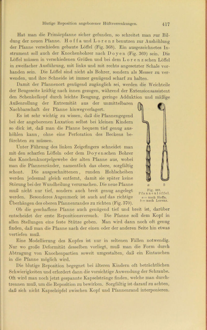 Hat man die Primärpfaniie sicher gefunden, so schreitet man zur Bil- dung der neuen Pfanne. H o f f a und Lorenz benutzen zur Aushöhlung der Pfanne verschieden gebaute Löffel (Fig. 368). Ein ausgezeichnetes In- strument soll auch der Knochenbohrer nach Doyen (Fig. 369) sein. Die Löffel müssen in verschiedenen Größen und bei dem Lorenz sehen Löffel in zweifacher Ausfühnmg, mit links und mit rechts angesetzter Schale vor- handen sein. Die Löffel sind nicht als Bohrer, sondern als Messer zu ver- wenden, rmd ihre Schneide ist immer genügend scharf zu halten. Damit der Pfannenort genügend zugänglich sei, werden die Weichteile der Beugeseite lo-äftig nach innen gezogen, während der Extensionsassistent den Schenkelkopf dirrch leichte Beugimg, geringe Adduktion und mäßige Außenrollimg der Extremität aus der rmmittelbaren Nachbarschaft der Pfanne hinwegverlagert. Es ist sehr wichtig zu wissen, daß die Pfannengegend bei der angeborenen Luxation selbst bei kleinen Kindern so dick ist, daß man die Pfanne bequem tief genug aus- höhlen kann, ohne eine Perforation des Beckens be- fürchten zu müssen. L^nter Führmig des linken Zeigefingers schneidet man mit den scharfen Löffeln oder dem Doyen sehen Bohrer das Knochenknorpelgewebe der alten Pfanne aus, wobei man die Pfannenränder, namentlich das obere, sorgfältig schont. Die ausgeschnittenen, runden Hohlscheiben werden jedesmal gleich entfernt, damit sie später keine Störung beider Wundheilung verursachen. Die neue Pfanne muß nicht nur tief, sondern auch breit genug angelegt werden. Besonderes Augenmerk ist auch auf das richtige Überhängen des oberen Pfannenrandes zu richten (Fig. 370). Ob die geschaffene Pfanne auch genügend tief und breit ist, darüber entscheidet der erste Kepositionsversuch. Die Pfanne soll dem Kopf in allen Stellungen eine feste Stütze geben. Man wird dann noch oft genug finden, daß man die Pfanne nach der einen oder der anderen Seite hin etwas vertiefen muß. Eine Modellierung des Kopfes ist nur in seltenen Fällen notwendig. Nur wo große Deformität desselben vorliegt, muß man die Form durch Abtragung von Knochenpartien soweit umgestalten, daß ein Eintauchen in die Pfanne möglich wird. Die blutige Reposition begegnet bei älteren Kindern oft beträchtlichen Schwierigkeiten und erfordert dann die vorsichtige Anwendung der Schraube. Oft wird man noch jetzt gespannte Kapselstränge finden, welche man durch- trennen muß, um die Reposition zu bewirken. Sorgfältig ist darauf zu achten, daß sich nicht Kapselzipfel zwischen Kopf und Pfannenrand interponieren. Fig. 368. Pfannenlöffel. a = naoli Hoffa. & = nach Lorenz.