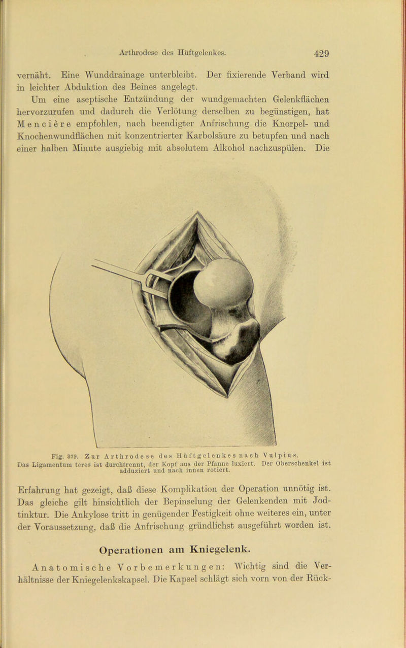 l i Ai'throdese des Hüftgelenkes. 429 vernälit. Eine Wunddrainage unterbleibt. Der fixierende Verband wird in leichter Abduktion des Beines angelegt. Um eine aseptische Entzündung der wundgemachten Gelenkflächen hervorzmufen und dadurch die Verlötung derselben zu begünstigen, hat M e n c i e r e empfohlen, nach beendigter Anfrischung die Knorpel- und Knochenwimdflächen mit konzentrierter Karbolsäure zu betupfen und nach einer halben Minute ausgiebig mit absolutem Alkohol nachzuspülen. Die j Fig. 379, Zur Arthrodese des Hüftgelenkes nach Vulpius. i, Das Ligamentum teres ist durchtrennt, der Kopf aus der Pfanne lasiert. Der Oberschenkel ist i adduziert und nach innen rotiert. I Erfahrung hat gezeigt, daß diese Komplikation der Operation unnötig ist. 1 Das gleiche gilt hinsichtlich der Bepinselung der Gelenkenden mit Jod- 1 tinktur. Die Ankylose tritt in genügender Festigkeit ohne weiteres ein, unter ^ der Voraussetzung, daß die Anfrischung gründlichst ausgeführt worden ist. I Operationen am Kniegelenk. I Anatomische Vorbemerkungen: Wichtig sind die Ver- 1 hältnisse der Kniegelenkskapsel. Die Kapsel schlägt sich vorn von der Rück-