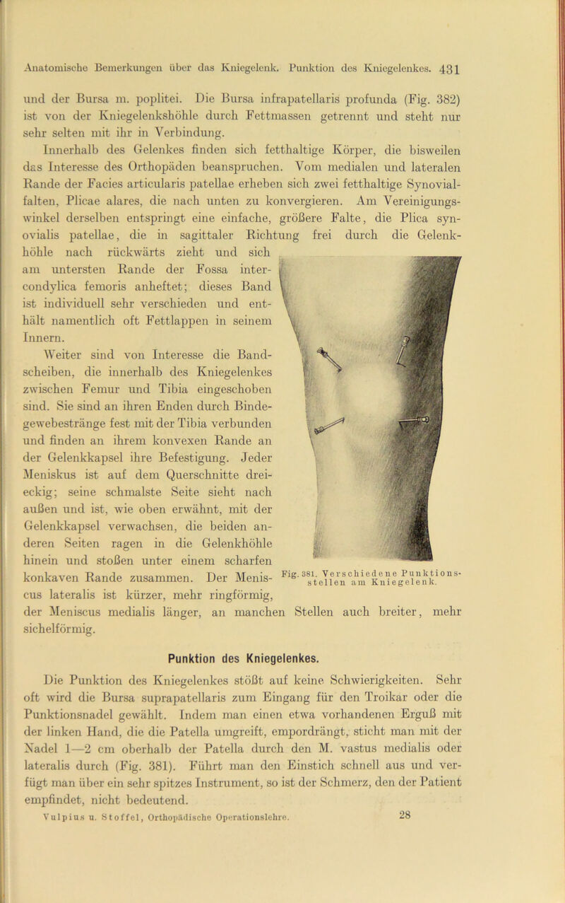 und der Bursa m. poplitei. Die Bursa infrapatellaris profunda (Fig. 382) ist von der Kniegelenkshöhle durch Fettmassen getrennt und steht nur sehr selten mit ihr in Verbindung. Innerhalb des Gelenkes finden sich fetthaltige Körper, die bisweilen das Interesse des Orthopäden beanspruchen. Vom medialen und lateralen Rande der Facies articularis pateUae erheben sich zwei fetthaltige Synovial- falten, Plicae alares, die nach unten zu konvergieren. Am Vereinigungs- winkel derselben entspringt eine einfache, größere Falte, die Plica syn- ovialis patellae, die in sagittaler Richtung frei durch die Gelenk- höhle nach rückwärts zieht und sich am imtersten Rande der Fossa inter- condylica femoris anheftet; dieses Band ist individuell sehr verschieden und ent- hält namentlich oft Fettlappen in seinem Innern. Weiter sind von Interesse die Band- scheiben, die innerhalb des Kniegelenkes zwischen Femur und Tibia eingeschoben sind. Sie sind an ihren Enden durch Binde- gewebestränge fest mit der Tibia verbunden und finden an ihrem konvexen Rande an der Gelenkkapsel ihre Befestigung. Jeder Meniskus ist auf dem Querschnitte drei- eckig; seine schmälste Seite sieht nach außen und ist, wie oben erwähnt, mit der Gelenkkapsel verwachsen, die beiden an- deren Seiten ragen in die Gelenkhöhle hinein und stoßen unter einem scharfen konkaven Rande zusammen. Der Menis- cus lateralis ist kürzer, mehr ringförmig, der Meniscus medialis länger, an manchen Stellen auch breiter, mehr sichelförmig. Punktion des Kniegelenkes. Die Punktion des Kniegelenkes stößt auf keine Schwierigkeiten. Sehr oft wird die Bursa suprapatellaris zum Eingang für den Troikar oder die Punktionsnadel gewählt. Indem man einen etwa vorhandenen Erguß mit der linken Hand, die die Patella umgreift, emj)ordrängt, sticht man mit der Nadel 1—2 cm oberhalb der Patella durch den M. vastus medialis oder lateralis durch (Fig. 381). Führt man den Einstich schnell aus und ver- fügt man über ein sehr spitzes Instrument, so ist der Schmerz, den der Patient empfindet, nicht bedeutend. Vulpiu.s u. Stoffel, Orthopildische Operationslehrc. 28