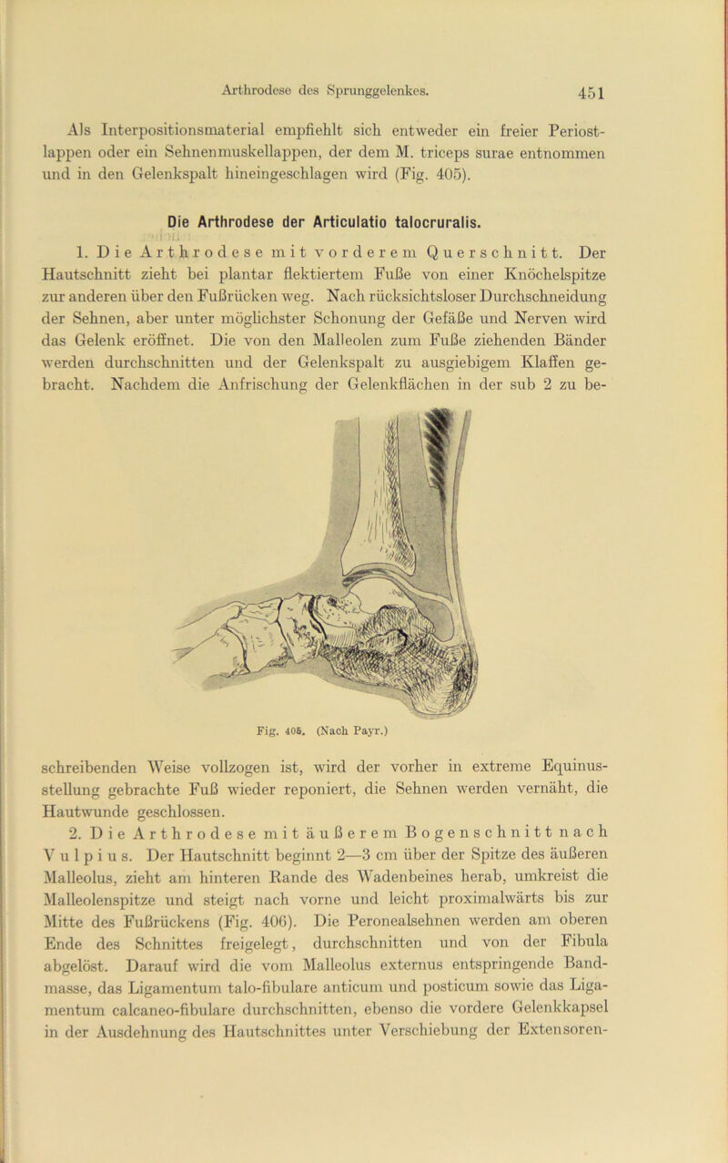 Als Interpositionsmaterial empfiehlt sich entweder ein freier Periost- lappen oder ein Sehnenmuskellappen, der dem M. triceps surae entnommen imd in den Gelenkspalt hineingeschlagen wird (Fig. 405). Die Arthrodese der Articulatio talocruralis. 1. Die Arthrodese mit vorderem Querschnitt. Der Hautschnitt zieht hei plantar flektiertem Fuße von einer Knöchelspitze zur anderen über den Fußrücken weg. Nach rücksichtsloser Durchschneidung der Sehnen, aber unter möglichster Schonung der Gefäße und Nerven wird das Gelenk eröffnet. Die von den Malleolen zum Fuße ziehenden Bänder werden durchschnitten und der Gelenkspalt zu ausgiebigem Klaffen ge- bracht. Nachdem die Anfrischung der Gelenkflächen in der sub 2 zu be- Fig. 40B. (Nach PajT.) schreibenden Weise vollzogen ist, wird der vorher in extreme Equinus- stellung gebrachte Fuß wieder reponiert, die Sehnen werden vernäht, die Hautwunde geschlossen. 2. Die Arthrodese mit äußerem Bogenschnitt nach V u 1 p i u s. Der Hautschnitt beginnt 2—3 cm über der Spitze des äußeren Malleolus, zieht am hinteren Rande des Wadenbeines herab, umkreist die Malleolenspitze und steigt nach vorne und leicht proximalwärts bis zur Glitte des Fußrückens (Fig. 406). Die Peronealsehnen werden am oberen Ende des Schnittes freigelegt, durchschnitten und von der Fibula abgelöst. Darauf wird die vom Malleolus externus entspringende Band- masse, das Ligamentum talo-flbulare anticum und posticum sowie das Liga- mentum calcaneo-fibulare durchschnitten, ebenso die vordere Gelenkkapsel in der Ausdehnung des Hautschnittes unter Verschiebung der E.xtensoren-