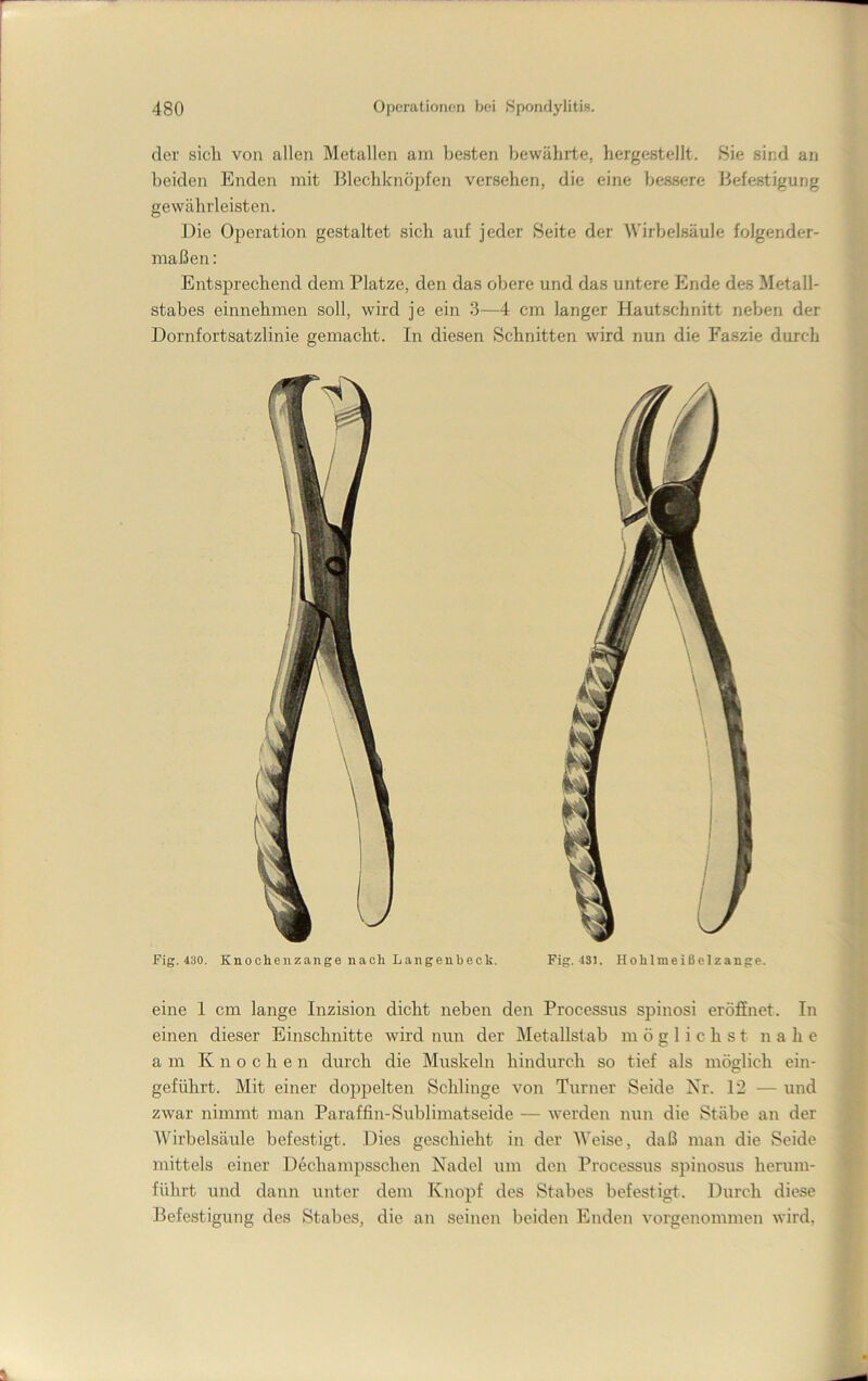 eine 1 cm lange Inzision dicht neben den Processus spinosi eröffnet. In einen dieser Einschnitte wird nun der Metallstab möglichst nahe am Knochen durch die Muskeln hindurch so tief als möglich ein- geführt. Mit einer doppelten Schlinge von Turner Seide Xr. 12 — und zwar nimmt man Paraffin-Sublimatseide — werden nun die Stäbe an der AVirbelsäule befestigt. Dies geschieht in der Weise, daß man die Seide mittels einer Dechampsschen Nadel um den Processus spinosus herum- führt und dann unter dem Knopf des Stabes befestigt. Dtirch diese Befestigung des Stabes, die an seinen beiden Enden vorgenommen wird, der sich von allen Metallen am besten bewährte, hergestellt. Sie sind an beiden Enden mit Blechknöpfen versehen, die eine bessere Befestigung gewährleisten. Die Operation gestaltet sich auf jeder Seite der M'irbelsäule folgender- maßen : Entsprechend dem Platze, den das obere und das untere Ende des Metall- stabes einnehmen soll, wird je ein 3—4 cm langer Hautschnitt neben der Dornfortsatzlinie gemacht. In diesen Schnitten wird nun die Faszie durch Fig. 430. Knocheiizange nach Langeubeck. Fig. 431. Hohlmeißelzange.