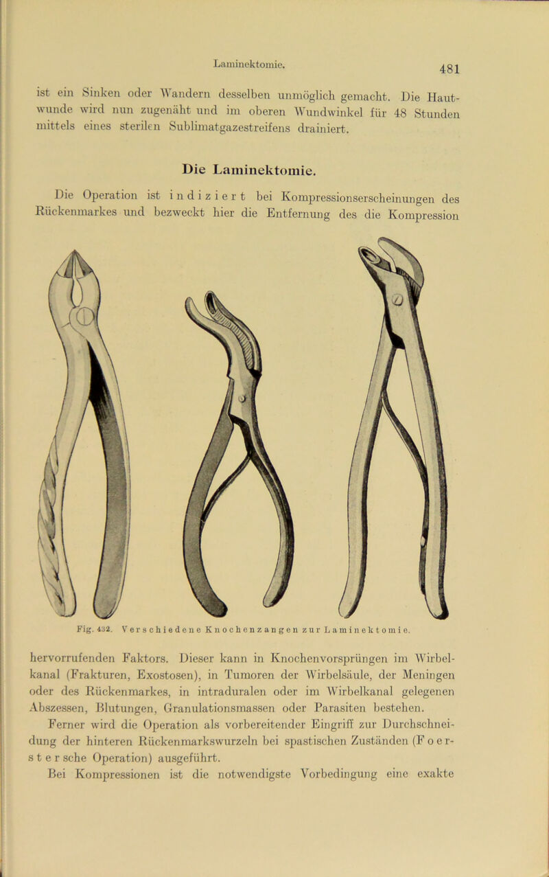 481 ist ein Sinken oder AVandern desselben unmöglich gemacht. Die Haut- wunde wird nun zugemäht und im oberen AVundwinkel für 48 Stunden mittels eines sterilen Sublimatgazestreifens drainiert. Die Lainiiiektomie. Die Operation ist indiziert bei Kompressionserscheinungen des Rückenmarkes und bezweckt hier die Entfernung des die Kompression Fig. 4U2. Verschiedene Knochenzangen zur Laminektoinie. hervorrufenden Faktors. Dieser kann in Knochenvors^irüngen im Wirbel- kanal (Frakturen, Exostosen), in Tumoren der Wirbelsäule, der Meningen oder des Rückenmarkes, in intraduralen oder im Wirbelkanal gelegenen Abszessen, Blutungen, Granulationsmassen oder Parasiten bestehen. Ferner wird die Operation als vorbereitender Eingriff zur Durchschnei- dung der hinteren Rückenmarkswurzeln bei spastischen Zuständen (F oer- s t e r sehe Operation) ausgeführt. Bei Kompressionen ist die notwendigste Vorbedingung eine exakte