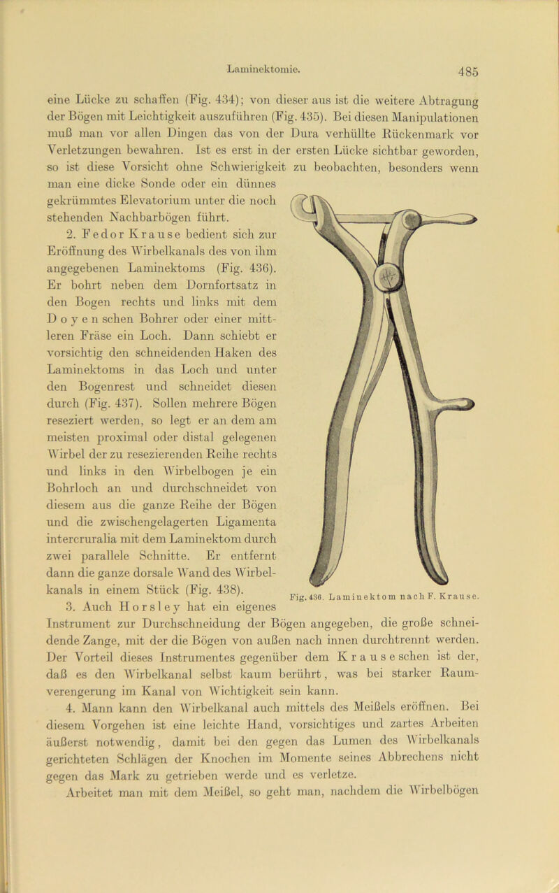 eine Lücke zu schaffen (Fig. 434); von dieser aus ist die weitere Abtragung der Bögen mit Leichtigkeit auszuführen (Fig. 435). Bei diesen Manipulationen muß man vor allen Dingen das von der Dura verhüllte Kückenmark vor Verletzungen bewahren. Ist es erst in der ersten Lücke sichtbar geworden, so ist diese Vorsicht ohne Schwierigkeit zu beobachten, besonders wenn man eine dicke Sonde oder ein dünnes gekrümmtes Elevatorium unter die noch stehenden Nachbarbögen führt. 2. F e d o r K r a u s e bedient sich zur Eröffnung des AVirbelkanals des von ihm angegebenen Laminektoms (Fig. 436). Er bohrt neben dem Dornfortsatz in den Bogen rechts und links mit dem Doyen sehen Bohrer oder einer mitt- leren Fräse ein Loch. Dann schiebt er vorsichtig den schneidenden Haken des Laminektoms in das Loch und unter den Bogenrest und schneidet diesen durch (Fig. 437). Sollen mehrere Bögen reseziert werden, so legt er an dem am meisten proximal oder distal gelegenen Wirbel der zu resezierenden Reihe rechts und links in den Wirbelbogen je ein Bohrloch an und durchschneidet von diesem aus die ganze Reihe der Bögen und die zwischengelagerten Ligamenta intercruralia mit dem Laminektom durch zwei parallele Schnitte. Er entfernt dann die ganze dorsale Wand des Wirbel- kanals in einem Stück (Fig. 438). 3. Auch H o r s 1 e y hat ein eigenes Instrument zur Durchschneidung der Bögen angegeben, die große schnei- dende Zange, mit der die Bögen von außen nach innen durchtrennt werden. Der Vorteil dieses Instrumentes gegenüber dem Krause sehen ist der, daß es den Wirbelkanal selbst kaum berührt, was bei starker Raum- verengerung im Kanal von Wichtigkeit sein kann. 4. Mann kann den Wirbelkanal auch mittels des Meißels eröffnen. Bei diesem Vorgehen ist eine leichte Hand, vorsichtiges und zartes Arbeiten äußerst notwendig, damit bei den gegen das Lumen des \\ irbelkanals gerichteten Schlägen der Knochen im Momente seines Abbrechens nicht gegen das Mark zu getrieben werde und es verletze. Arbeitet man mit dem Meißel, so geht man, nachdem die M irbelbögen