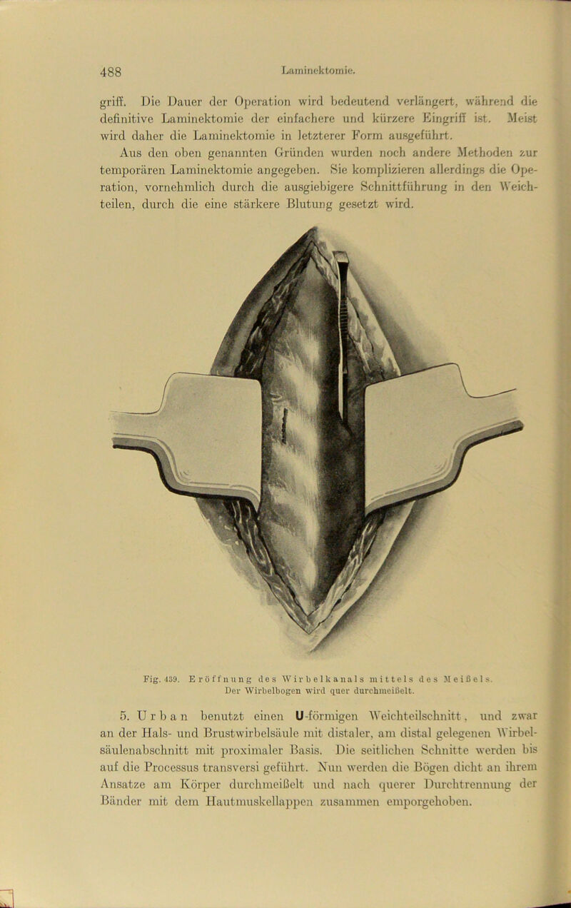 griff. Die Dauer der O])ei'ation wird bedeutend verlängert, während die definitive Laininektomie der einfachere und kürzere Eingriff ist. Meist wird daher die Laminelctomie in letzterer Form ausgeführt. Aus den oben genannten Gründen wurden noch andere Methoden zur temporären Laminektomie angegeben. Sie komplizieren allerdings die Ope- ration, vornehmlich durch die ausgiebigere Schnittführung in den Weich- teilen, durch die eine stärkere Blutung gesetzt wird. Fig.'isa. Eröffnung des W ir b e 1 k a na 1 s mittels des Meißels. Der Wirbelbogen wird quer durchnieißelt. 5. Urban benutzt einen U-förmigen Weichteilschnitt, und zwar an der Hals- und Brustwirbelsäule mit distaler, am distal gelegenen Wirbel- säulenabschnitt mit proximaler Basis. Die seitlichen Schnitte werden bis auf die Processus transversi geführt. Nun werden die Bögen dicht an ihrem Ansätze am Körper durchnieißelt und nach querer Durchtrennung der Bänder mit dem Hautmuskellappen zusammen emporgehoben.