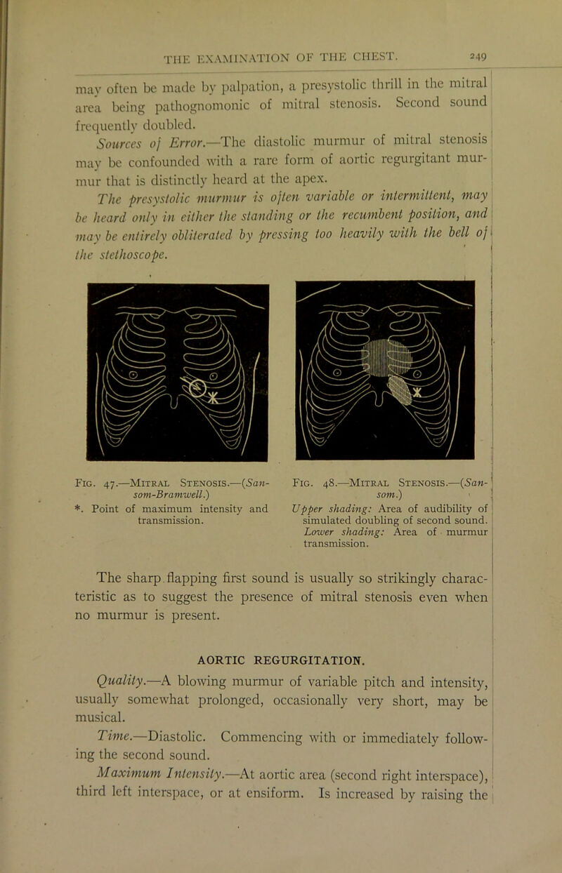 may often be made by palpation, a presystolic thrill in the mitral area being pathognomonic of mitral stenosis. Second sound frequently doubled. Sources oj Error.—The diastolic murmur of mitial stenosis may be confounded with a rare form of aortic regurgitant mur- mur that is distinctly heard at the apex. The presystolic murmur is ojten variable or intermittent, may be heard only in cither the standing or the recumbent position, and may he entirely obliterated by pressing too heavily with the bell oj i the stethoscope. Fig. 47.—Mitral Stenosis.—(San- som-Bramwell.) *. Point of maximum intensity and transmission. Fig. 48.—Mitral Stenosis.—{San- som.) • ’ Upper shading: Area of audibility of simulated doubling of second sound. Lower shading: Area of murmur transmission. The sharp flapping first sound is usually so strikingly charac- teristic as to suggest the presence of mitral stenosis even when no murmur is present. ' AORTIC REGURGITATION. Quality.—A blowing murmur of variable pitch and intensity, usually somewhat prolonged, occasionally very short, may be musical. Time.—Diastolic. Commencing with or immediately follow- ing the second sound. Maximum Intensity.—At aortic area (second right interspace), third left interspace, or at ensiform. Is increased by raising the