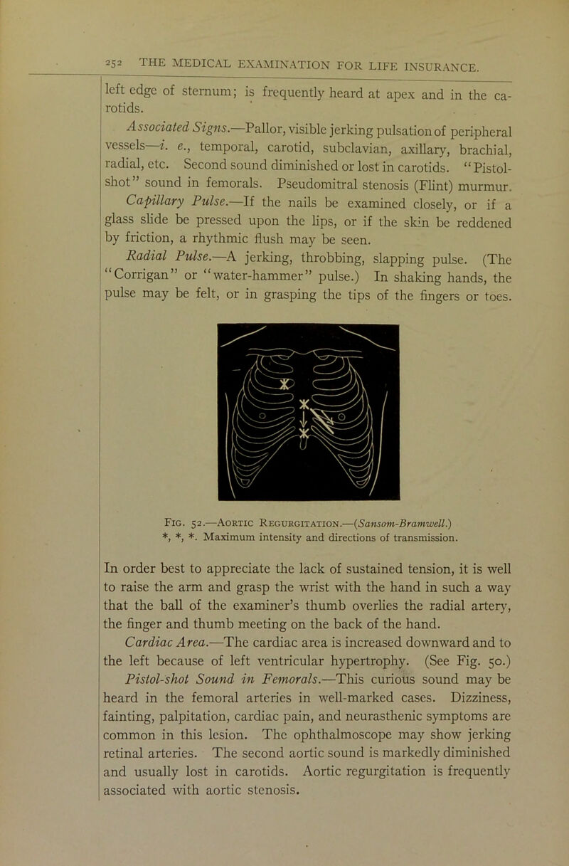 left edge of sternum; is frequently heard at apex and in the ca- rotids. Associated Signs. Pallor, visible jerking pulsation of peripheral vessels i. e., temporal, carotid, subclavian, axillary, brachial, radial, etc. Second sound diminished or lost in carotids. “Pistol- shot sound in femorals. Pseudomitral stenosis (Flint) murmur. Capillary Pulse.—If the nails be examined closely, or if a glass slide be pressed upon the lips, or if the skin be reddened by friction, a rhythmic flush may be seen. Radial Pulse.—A jerking, throbbing, slapping pulse. (The “Corrigan” or “water-hammer” pulse.) In shaking hands, the pulse may be felt, or in grasping the tips of the fingers or toes. Fig. 52.—Aortic Regurgitation.—(Sansom-Bramwell.) *, *, *. Maximum intensity and directions of transmission. In order best to appreciate the lack of sustained tension, it is well to raise the arm and grasp the wrist with the hand in such a way that the ball of the examiner’s thumb overlies the radial artery, the finger and thumb meeting on the back of the hand. Cardiac Area.—The cardiac area is increased downward and to the left because of left ventricular hypertrophy. (See Fig. 50.) Pistol-shot Sound in Femorals.—This curious sound may be heard in the femoral arteries in well-marked cases. Dizziness, fainting, palpitation, cardiac pain, and neurasthenic symptoms are common in this lesion. The ophthalmoscope may show jerking retinal arteries. The second aortic sound is markedly diminished and usually lost in carotids. Aortic regurgitation is frequently associated with aortic stenosis.