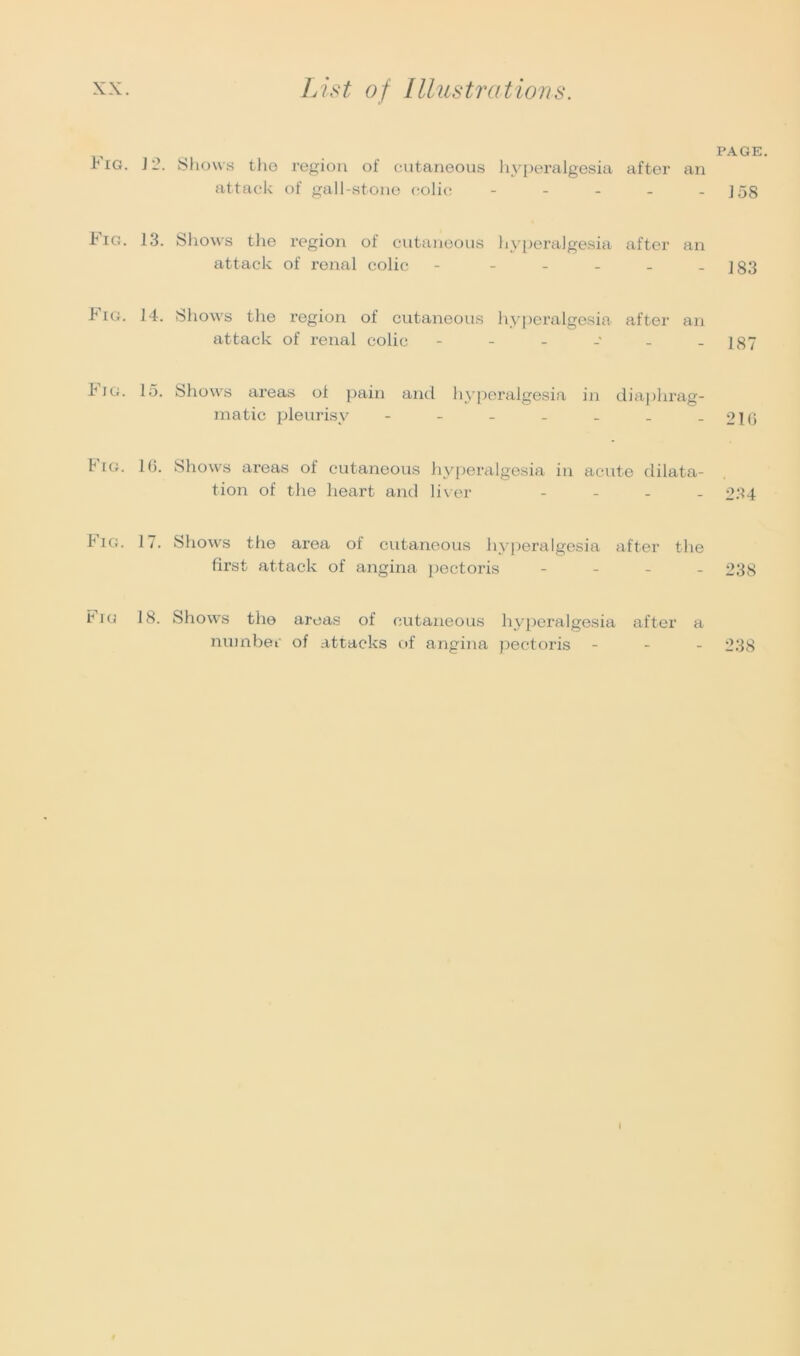 PAGE. pig. 12. Shows the region oi cutaneous hyperalgesia after an attack of gall-stone colic - - - - - 158 Fig. 13. Shows the region of cutaneous hyperalgesia after an attack of renal colic - - - - - - 183 k ig. 14. Shows the region of cutaneous hyperalgesia after an attack of renal colic - - - - - - 187 Pig. 15. Shows areas ol pain and hyperalgesia in diaphrag- matic pleurisy - - - - - . -21G k ig. 16. Shows areas oi cutaneous hyperalgesia in acute dilata- tion of the heart and liver - 234 kiG. 17. Shows the area of cutaneous hyperalgesia after the first attack of angina pectoris - 238 pig 18. Shows the areas of cutaneous hyperalgesia after a number of attacks of angina pectoris - 238