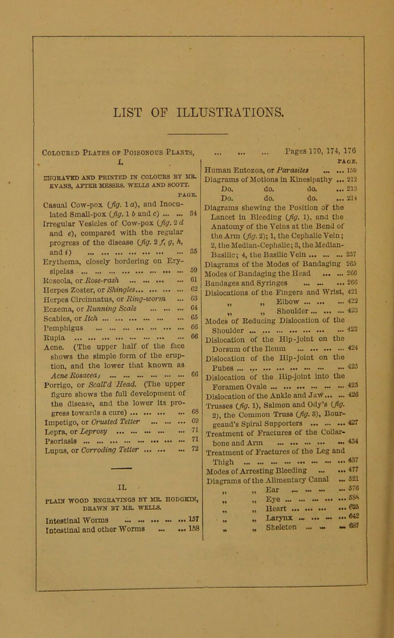 LIST OF ILLUSTEATIONS, Coloured Plates of Poisonous Plants, L ENQUAVKD AND PRINTED IN COLOURS BT MB. EVANS, AFTER MESSES. WELLS AND SCOTT. PAOB. Casual Cow-pox (Jff. 1 a), and Inocu- lated Small-pox (Jig. 1 i and c) 34 Irregular Vesicles of Cow-pox (^g. Id and c), compared with the regular progress of the disease (Jig. 2 /, jr, A, andf) 35 Erythema, closely bordering on Ery- sipelas 39 Koseola, or Rose-rash 01 Herpes Zoster, or Shingles 03 Herpes Cirehmatus, or Ring-wonn ... 63 Eczema, or Running Scale 04 Scabies, or Itch 05 Pemphigus 00 Rupia 06 Acne. (The upper half of the face shows the simple form of the erup- tion, and the lower that known ns Acne Rosacea/ 60 Porrigo, or ScalVd Head. (The upper figure shows the full development of the disease, and the lower its pro- gress towards a cure) 08 Impetigo, or Crusted Tetter 09 Lepra, or Lejirosy ' i Psoriasis Lupus, or Corroding Tetter 72 IL PLAIN WOOD BNGRAVINQS BT ME. HODGKIN, DRAWN B7 MR. WELLS. Intestinal Wonns 131 Intestinal and other TVorms ... ... 168 Pages 170, 174, 176 PAGE. Human Entozoa, or Parasites ... 159 Diagrams of Motions in Kineslpathy ... 212 Do. do. do. ... 213 Do. do. do. ... 214 Diagrams shewing the Position of the Lancet In Bleeding (fig. I), and the Anatomy of the Veins at the Bend of the Arm (fig. 2); 1, the Cephalic Vein; 2, the Median-Cephalic; 3, the Median- Basilic; 4, the Basilic Vein 257 Diagrams of the Modes of Bandaging 265 Modes of Bandaging the Head 200 Bandages and Syringes ... ... 266 Dislocations of the Fingers and Wrist, 421 „ „ Elbow 422 „ „ Shoulder 423 Modes of Reducing Dislocation of the Shoulder 423 Dislocation of the Hip-joint on the Dorsum of the Henm 424 Dislocation of the Hip-joint on the Pubes ... ., 425 Dislocation of the Hip-johit into the Foramen Ovale 425 Dislocation of tlio Ankle and Jaw 426 Trusses (Jig. 1), Salmon and Ody’s (Jig. 2), the Common Truss (Jig. 3), Bour- geaud’s Spiral Supporters 427 Treatment of Fractures of the Collar- bone and Ann 434 Treatment of Fractures of the Leg and Thigh ™ ••• ... 437 Modes of Arresting Bleeding ...477 Diagrams of the Alimentary Canal 521 „ „ Ear .„ ~ ... „. 570 .. Eye ™ ... 5S8 „ „ Heart ... 625 .. „ Larynx ~ ... 642 „ „ Skeleton ... ». . 687
