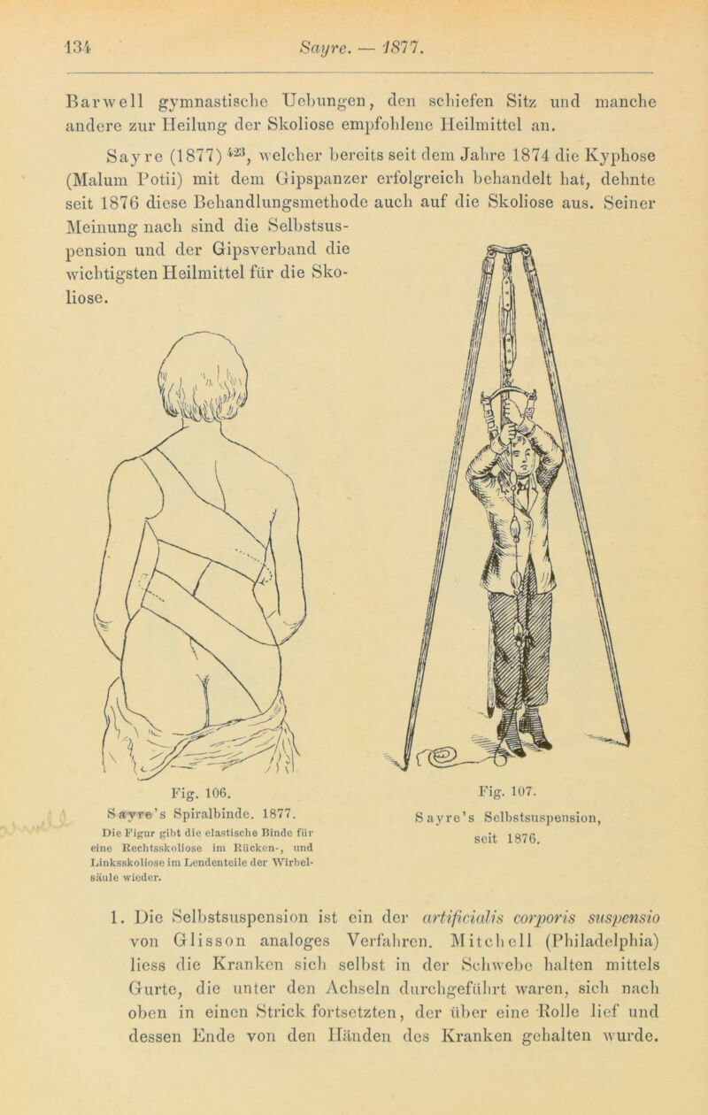 Barwell gymnastische Uebungen, den schiefen Sitz und manche andere zur Heilung der Skoliose empfohlene Heilmittel an. Sayre (1877) 423, welcher bereits seit dem Jahre 1874 die Kyphose (Malum Potii) mit dem Gipspanzer erfolgreich behandelt hat, dehnte seit 1876 diese Behandlungsmethode auch auf die Skoliose aus. Seiner Meinung nach sind die Selbstsus- pension und der Gipsverband die wichtigsten Heilmittel für die Sko- liose. Die Figur gibt die elastische Binde für eine Rechtsskoliose im Rücken-, und Linksskoliose im Lendenteile der Wirbel- säule wieder. Fig. 107. Sayrc’s Selbstsuspension, seit 1876. 1. Die Selbstsuspension ist ein der artificialis corporis suspensio von Glisson analoges Verfahren. Mitchell (Philadelphia) liess die Kranken sich selbst in der Schwebe halten mittels Gurte, die unter den Achseln durchgeführt waren, sich nach oben in einen Strick fortsetzten, der über eine Holle lief und dessen Ende von den Händen des Kranken gehalten wurde.